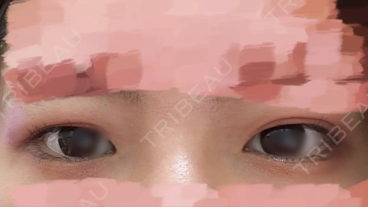 施術後の写真