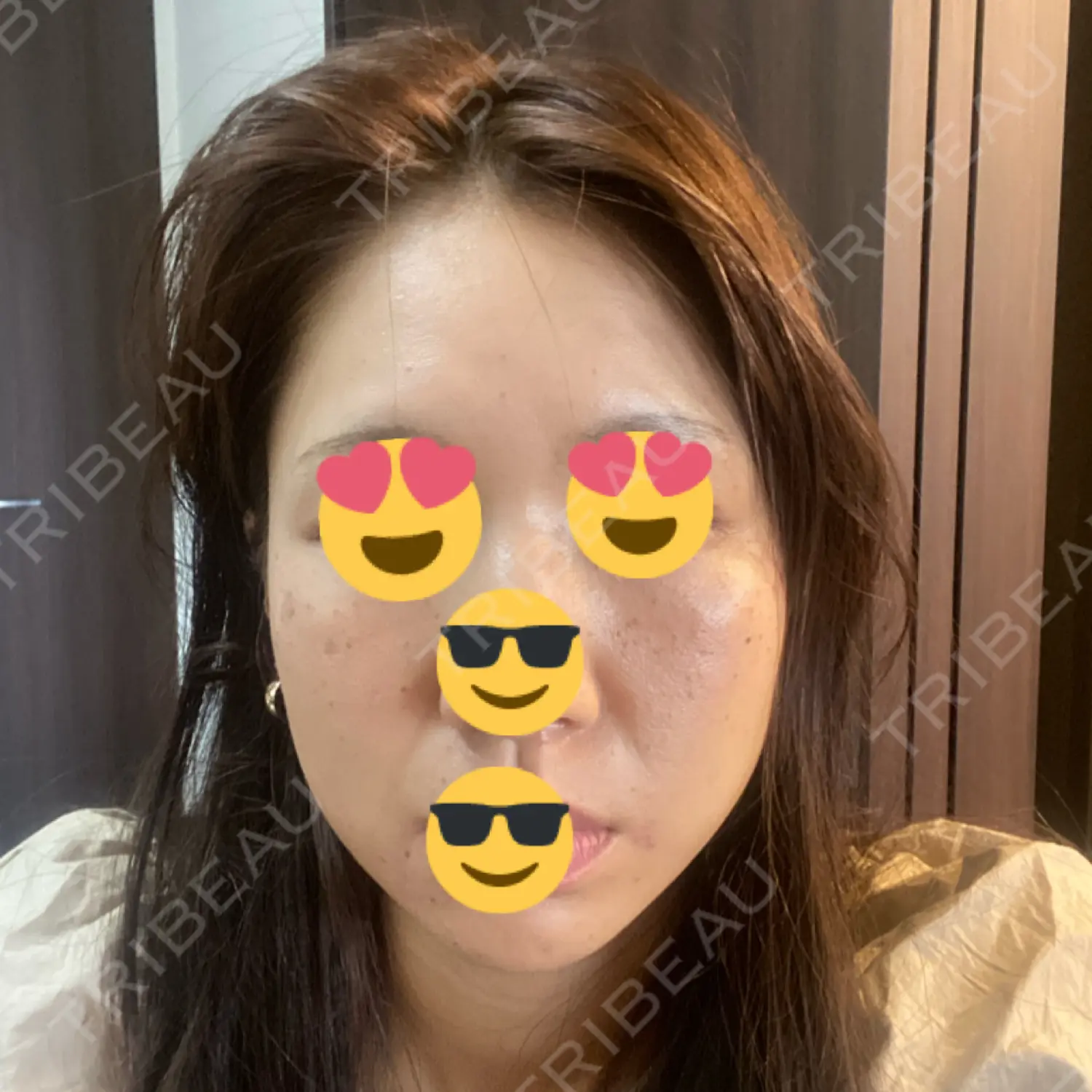 施術後の写真