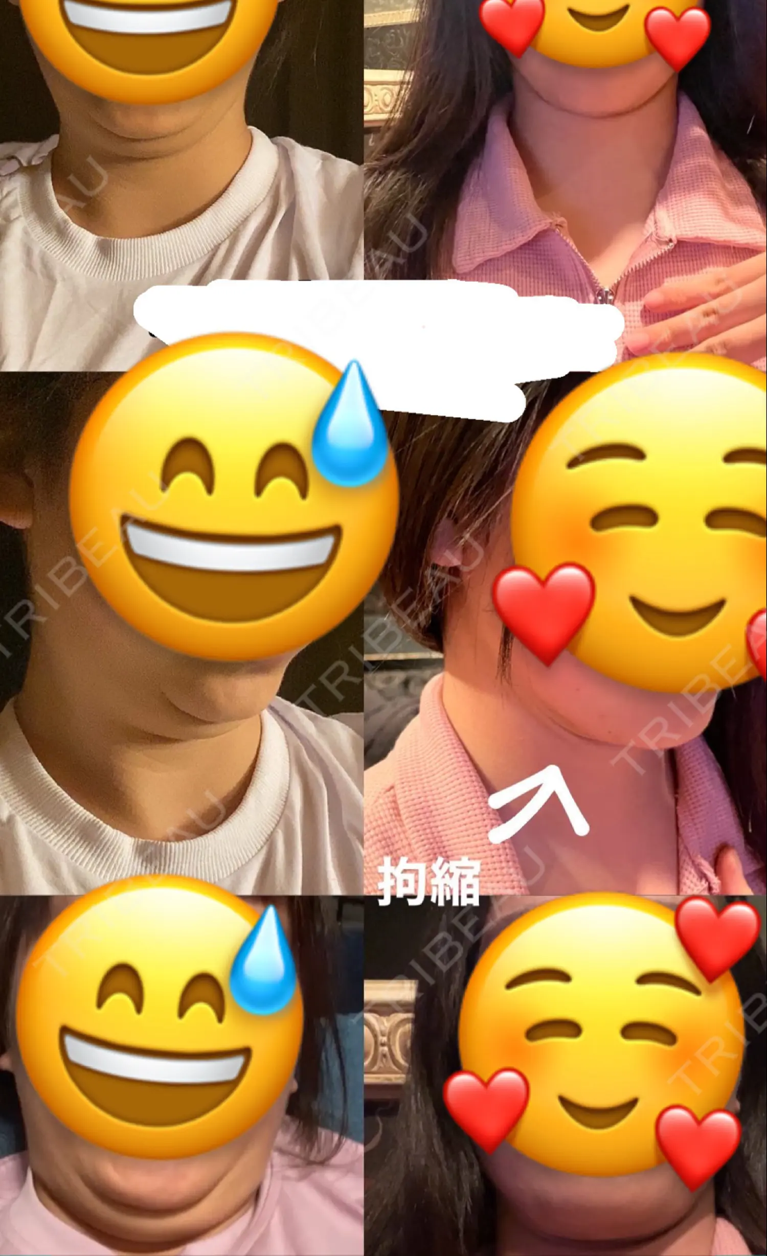 施術後の写真