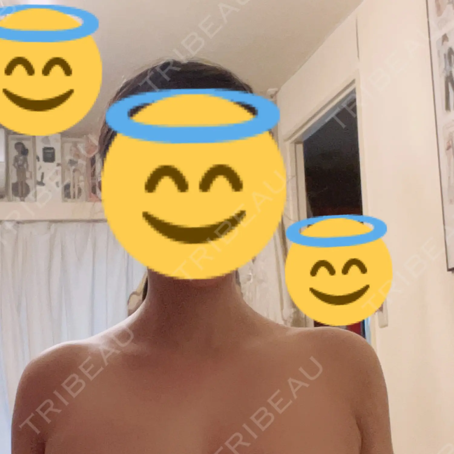 施術後の写真