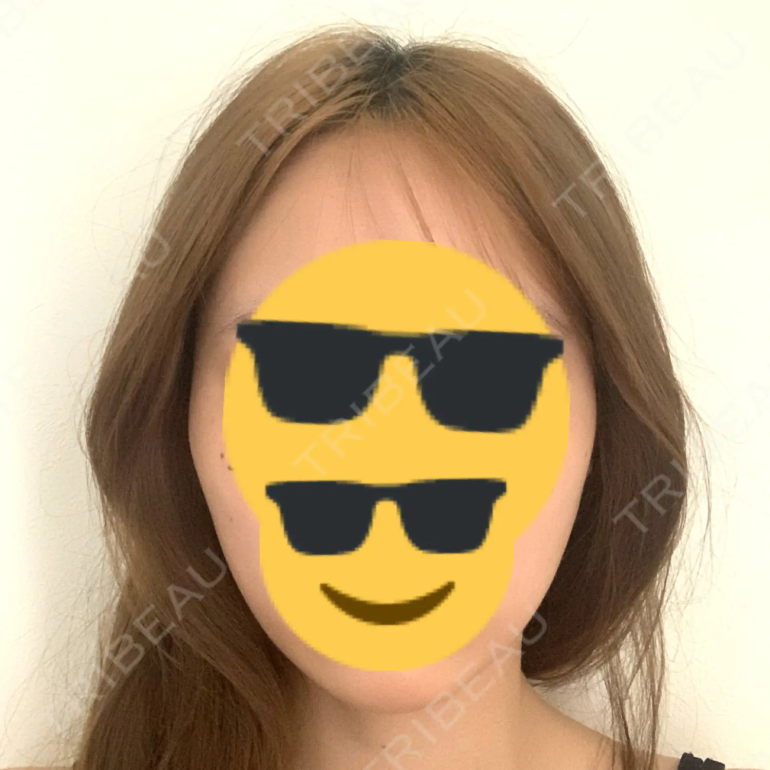 施術後の写真