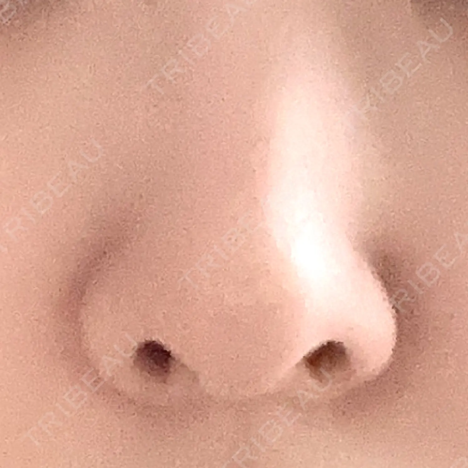 施術後の写真