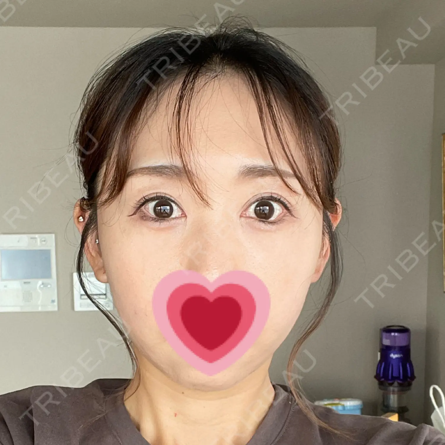 施術後の写真