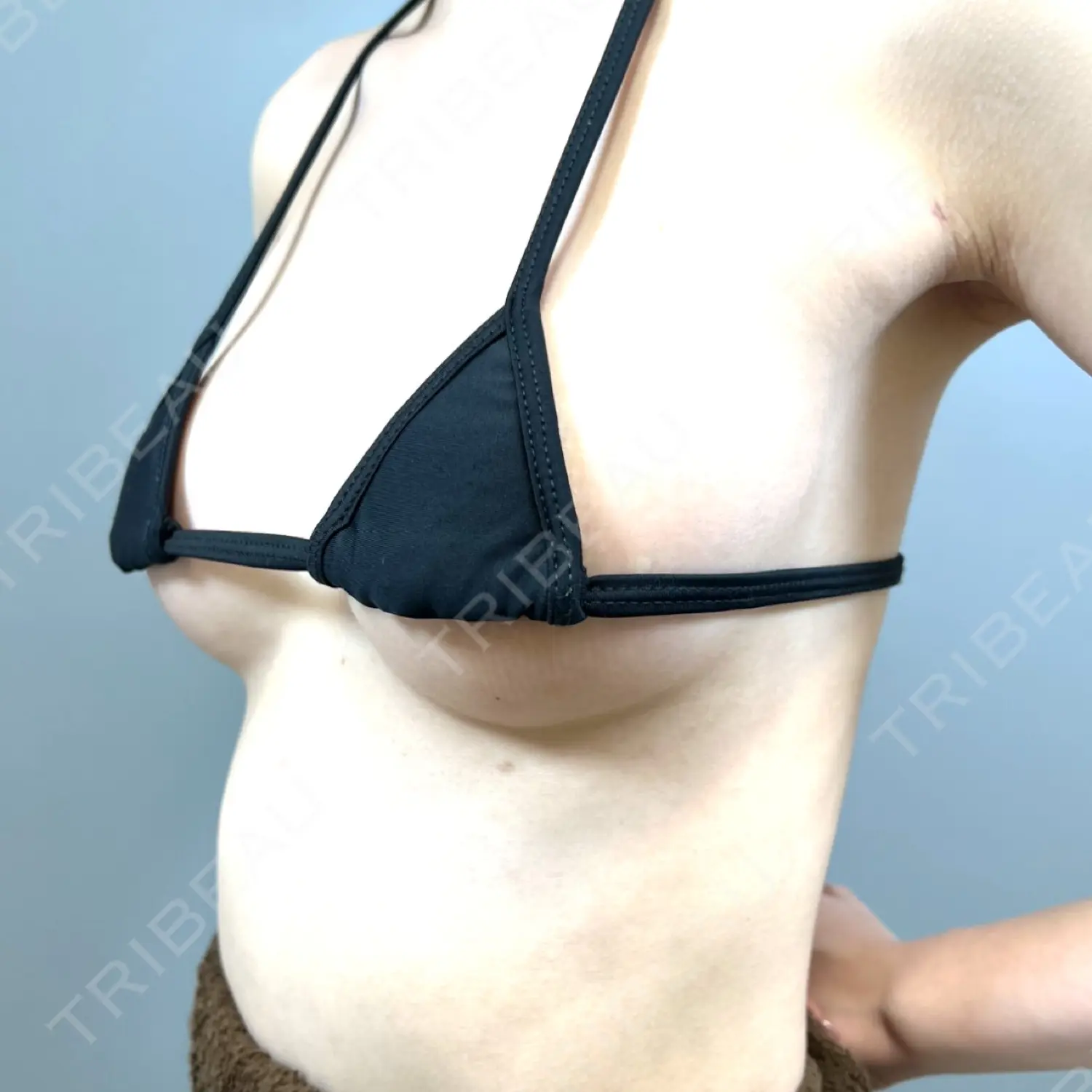 施術後の写真