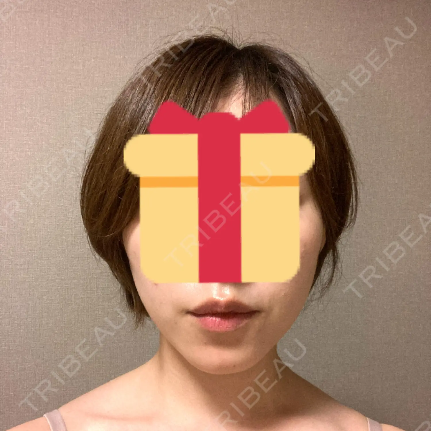 施術後の写真