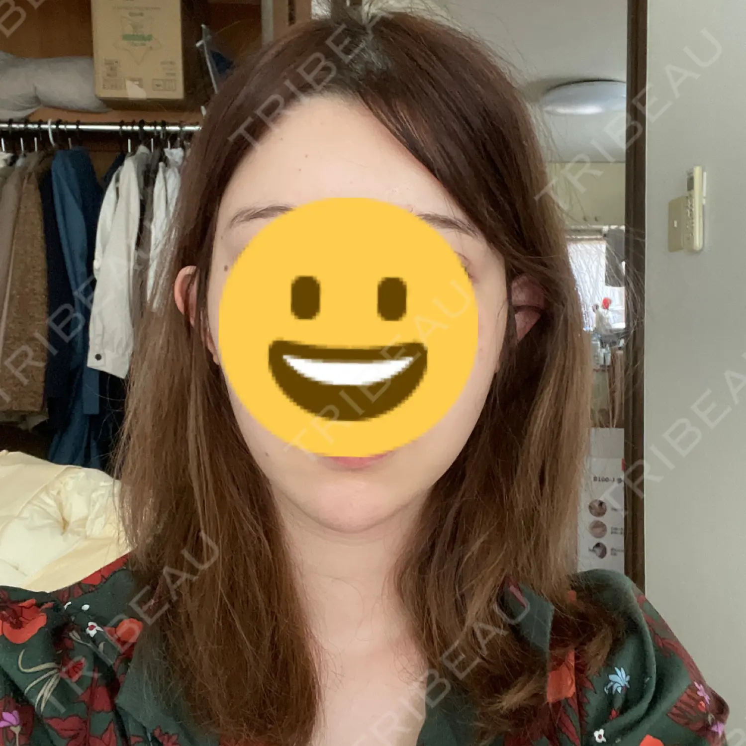 施術後の写真