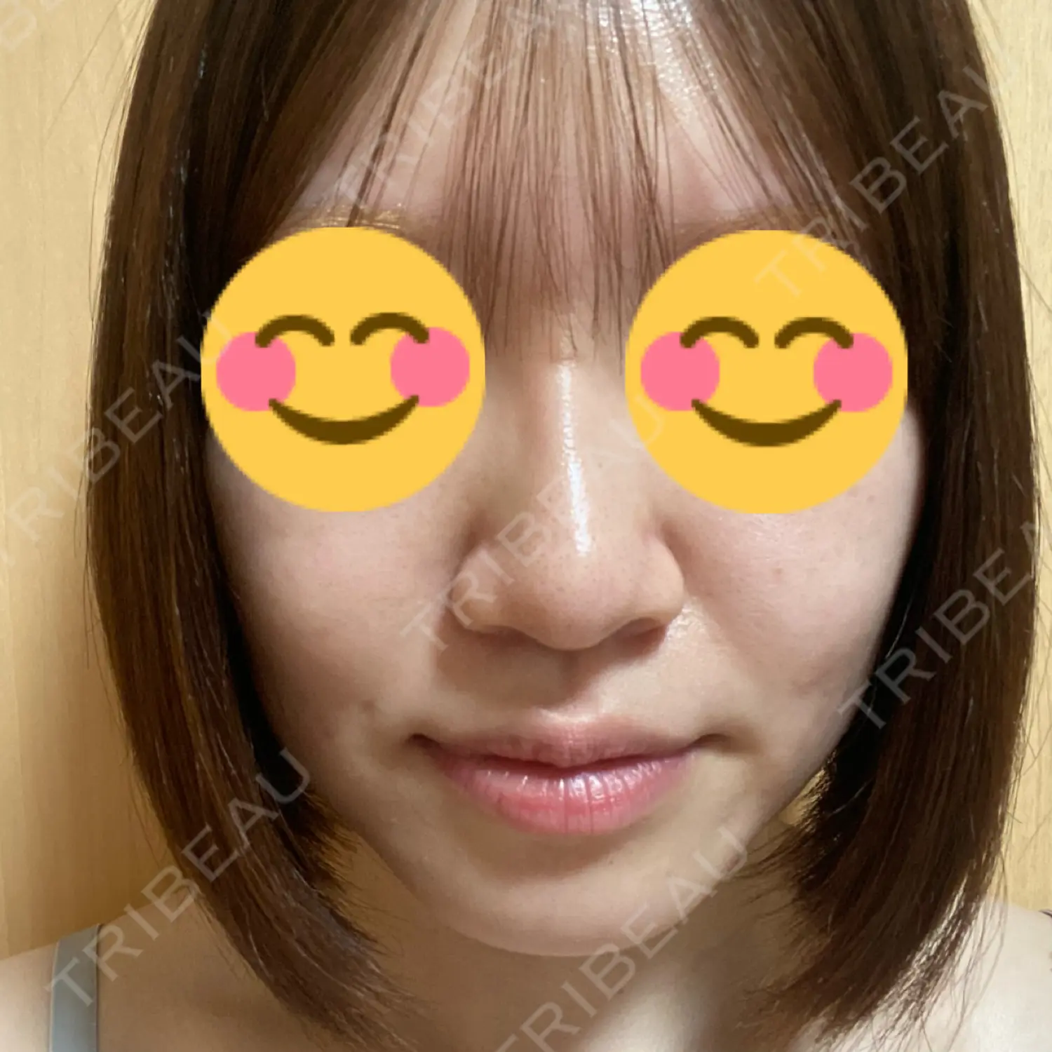 施術後の写真