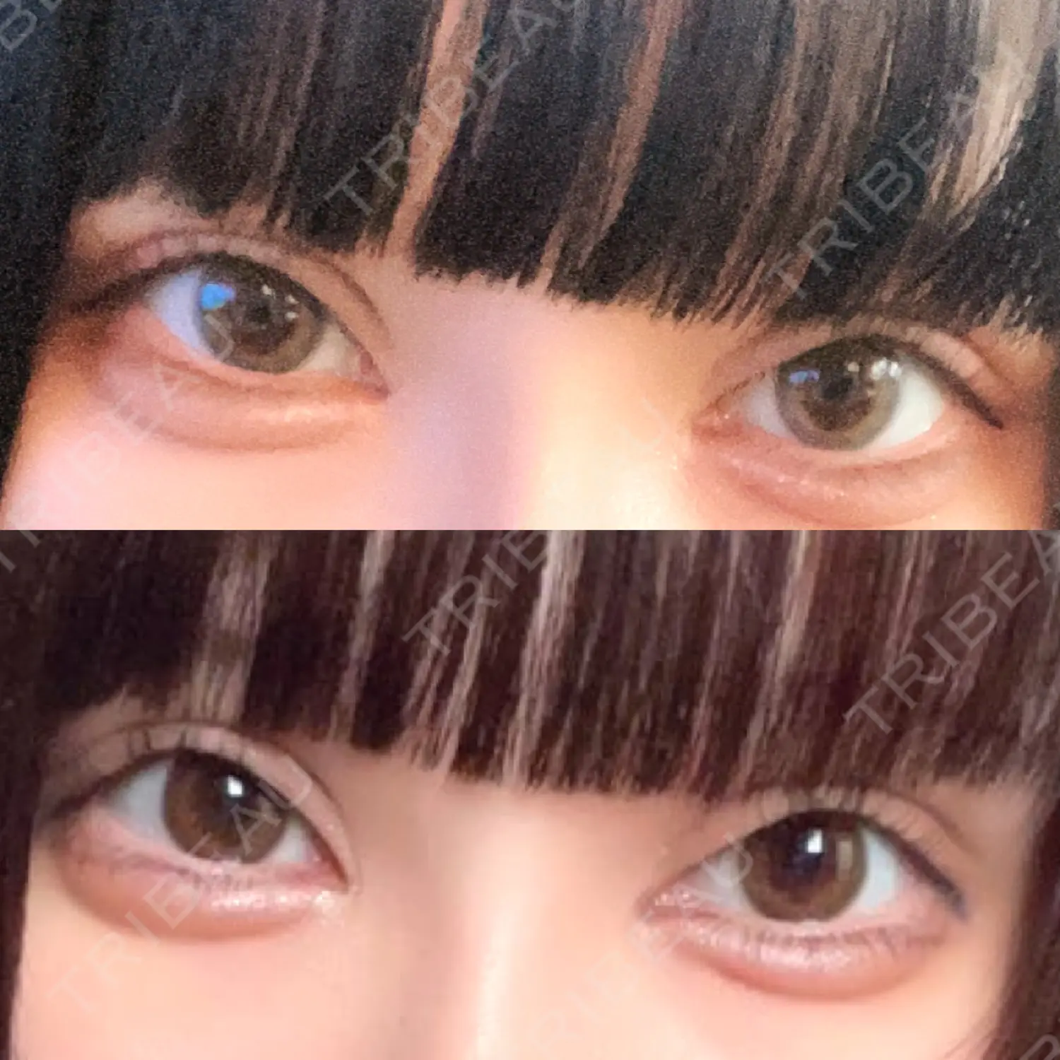 施術後の写真