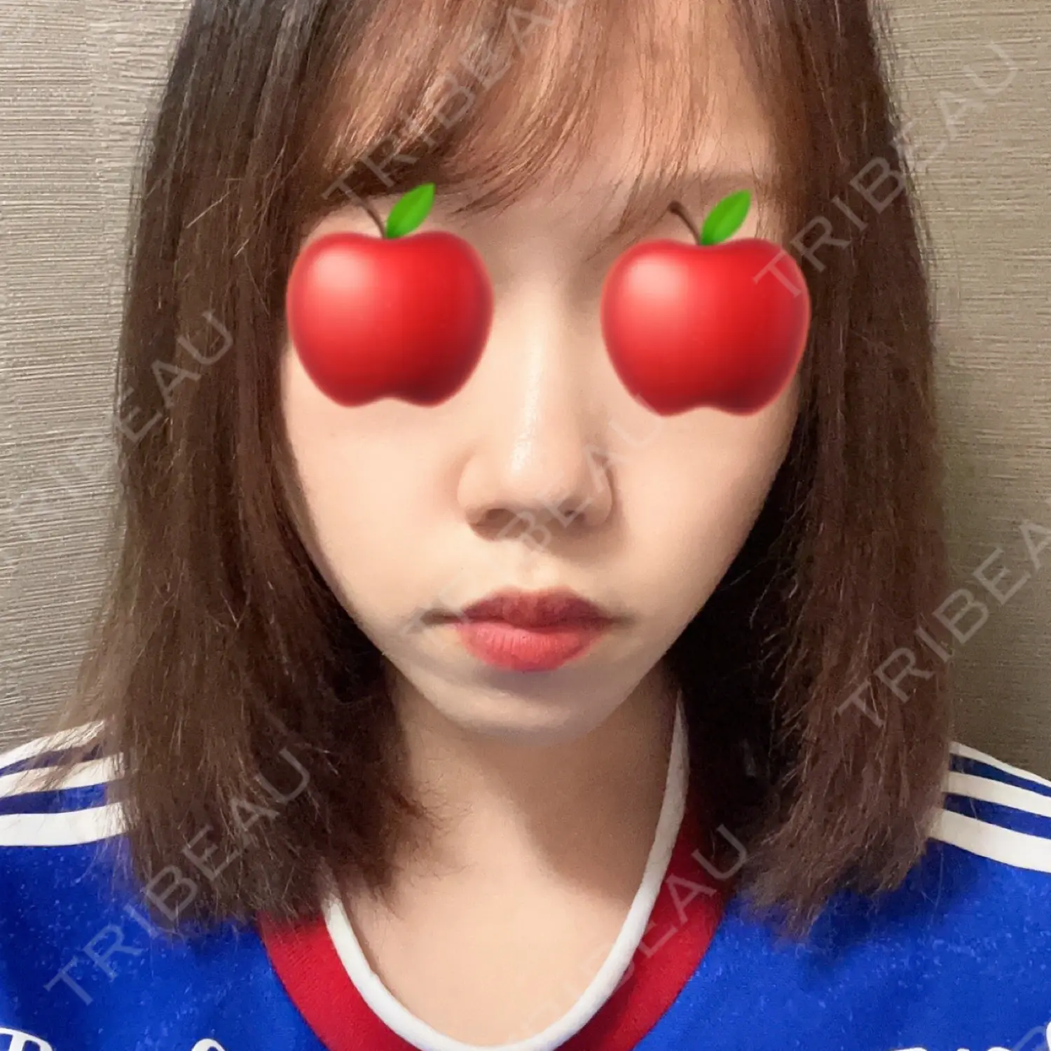 施術後の写真