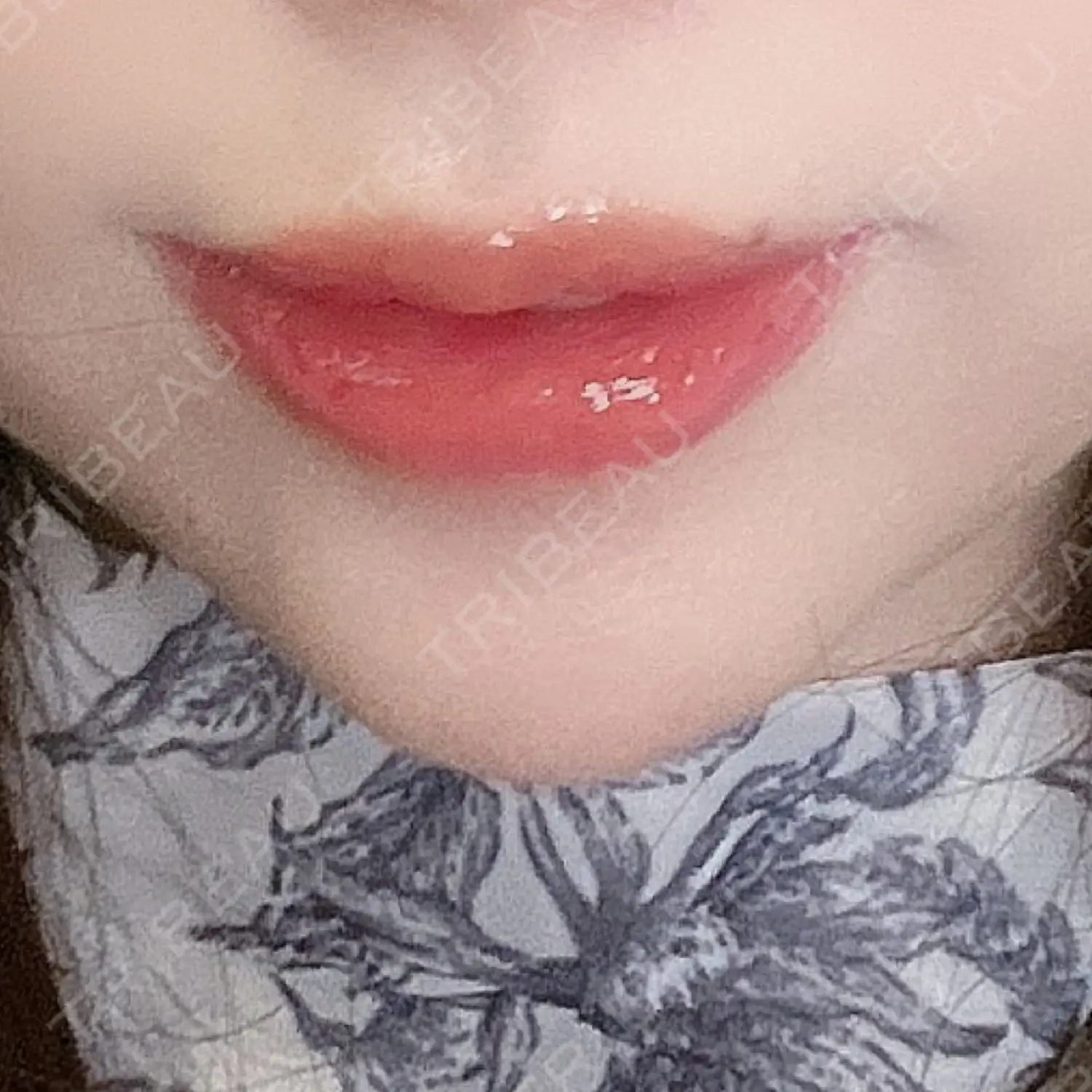 施術後の写真