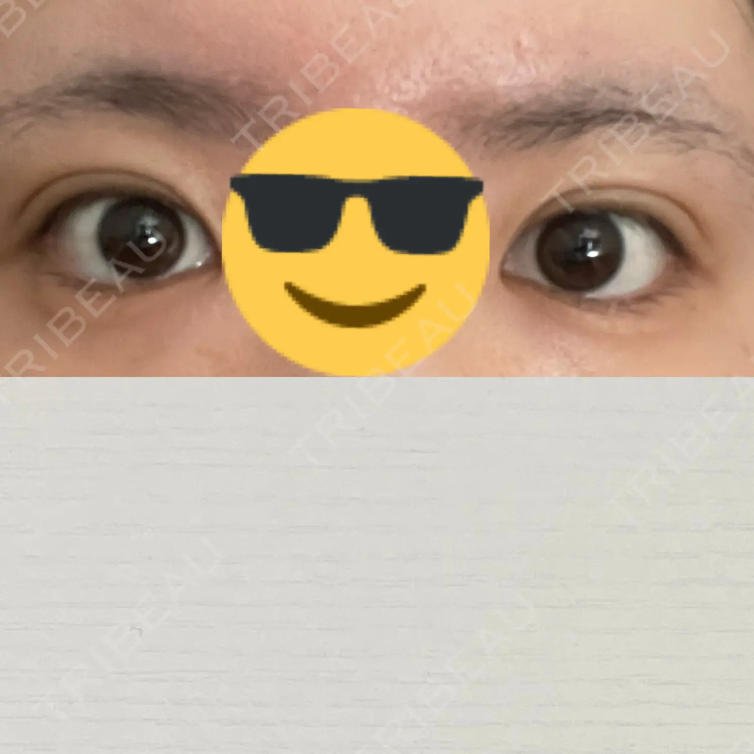 施術後の写真