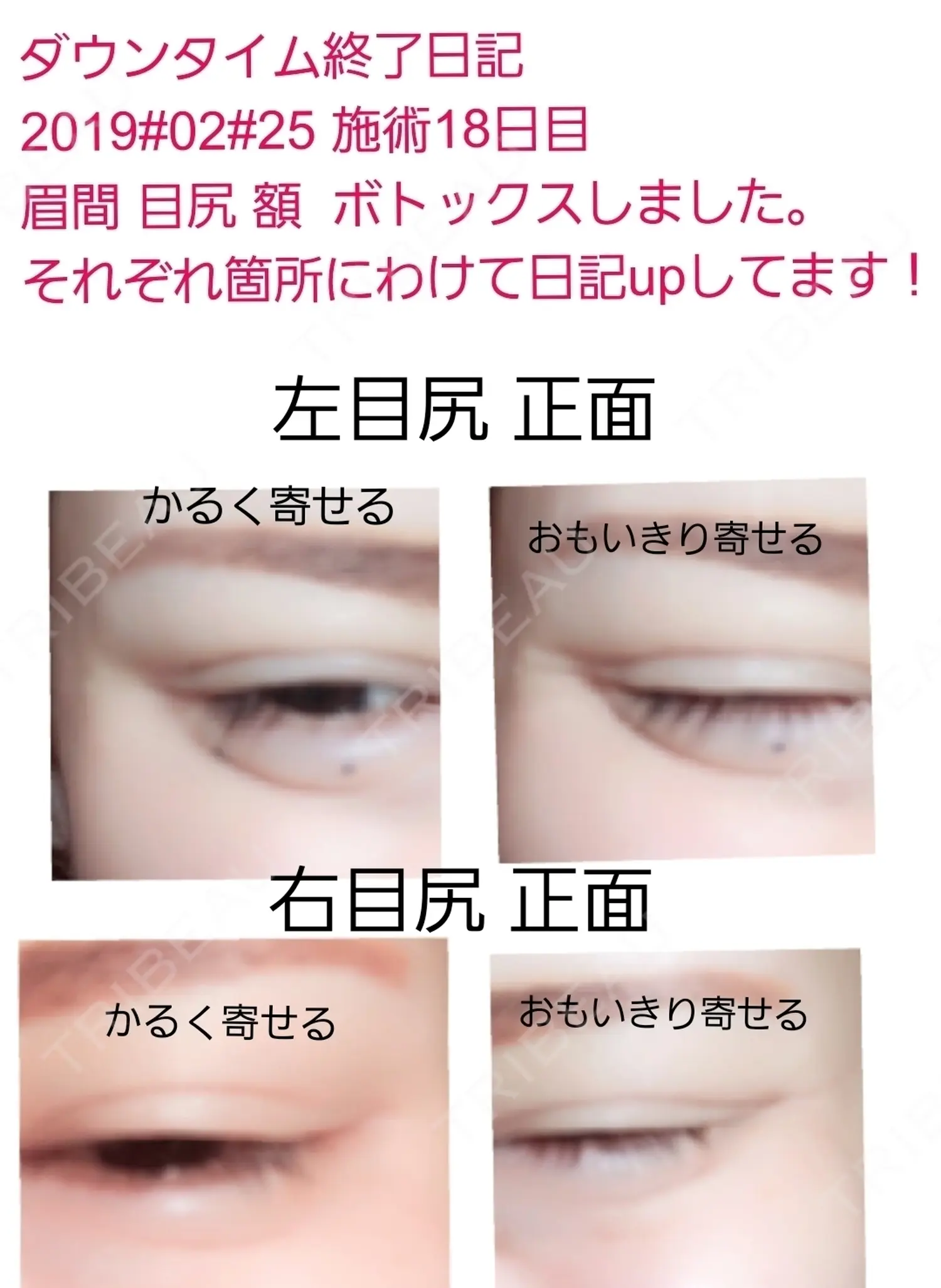 施術後の写真