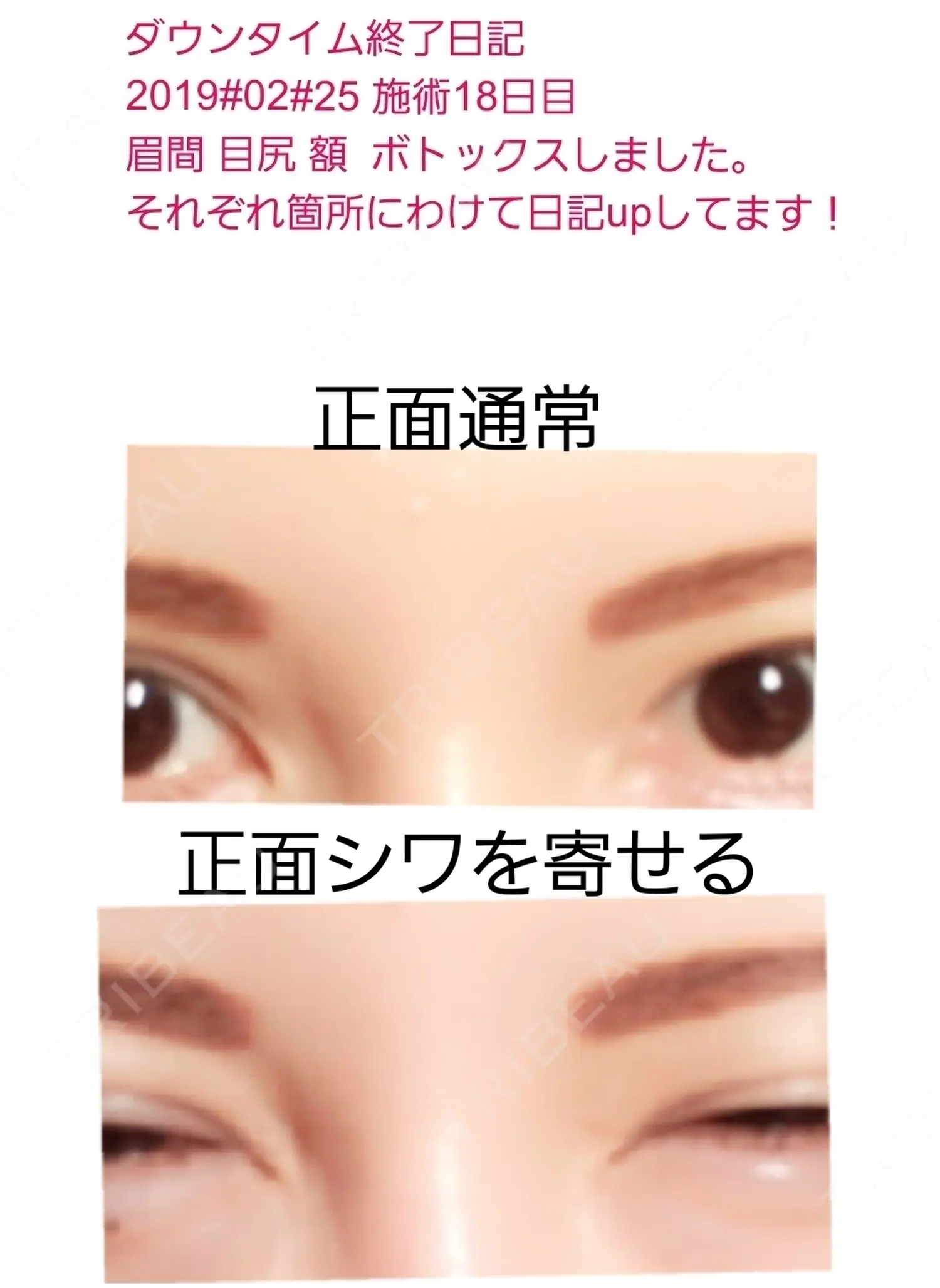 施術後の写真