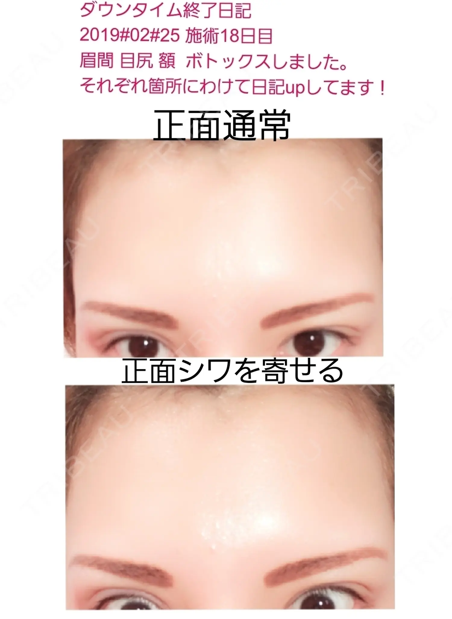 施術後の写真