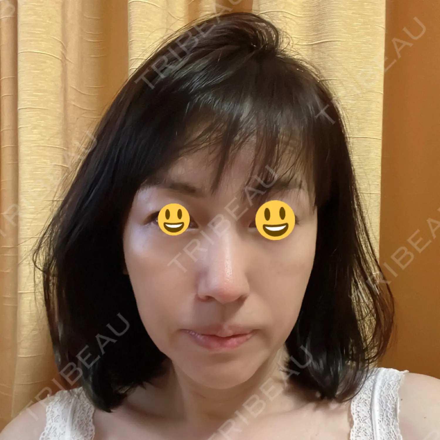 施術後の写真
