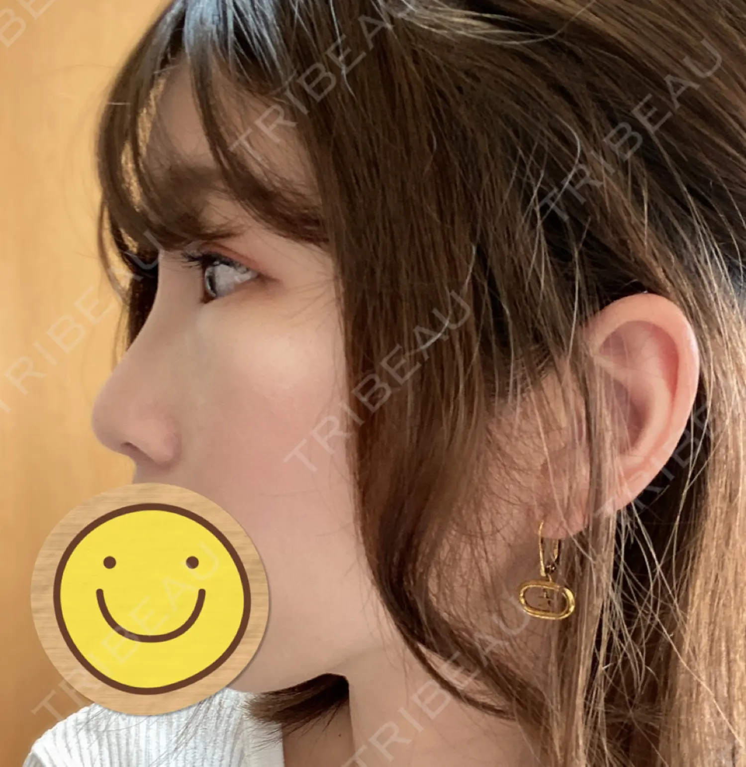 施術後の写真