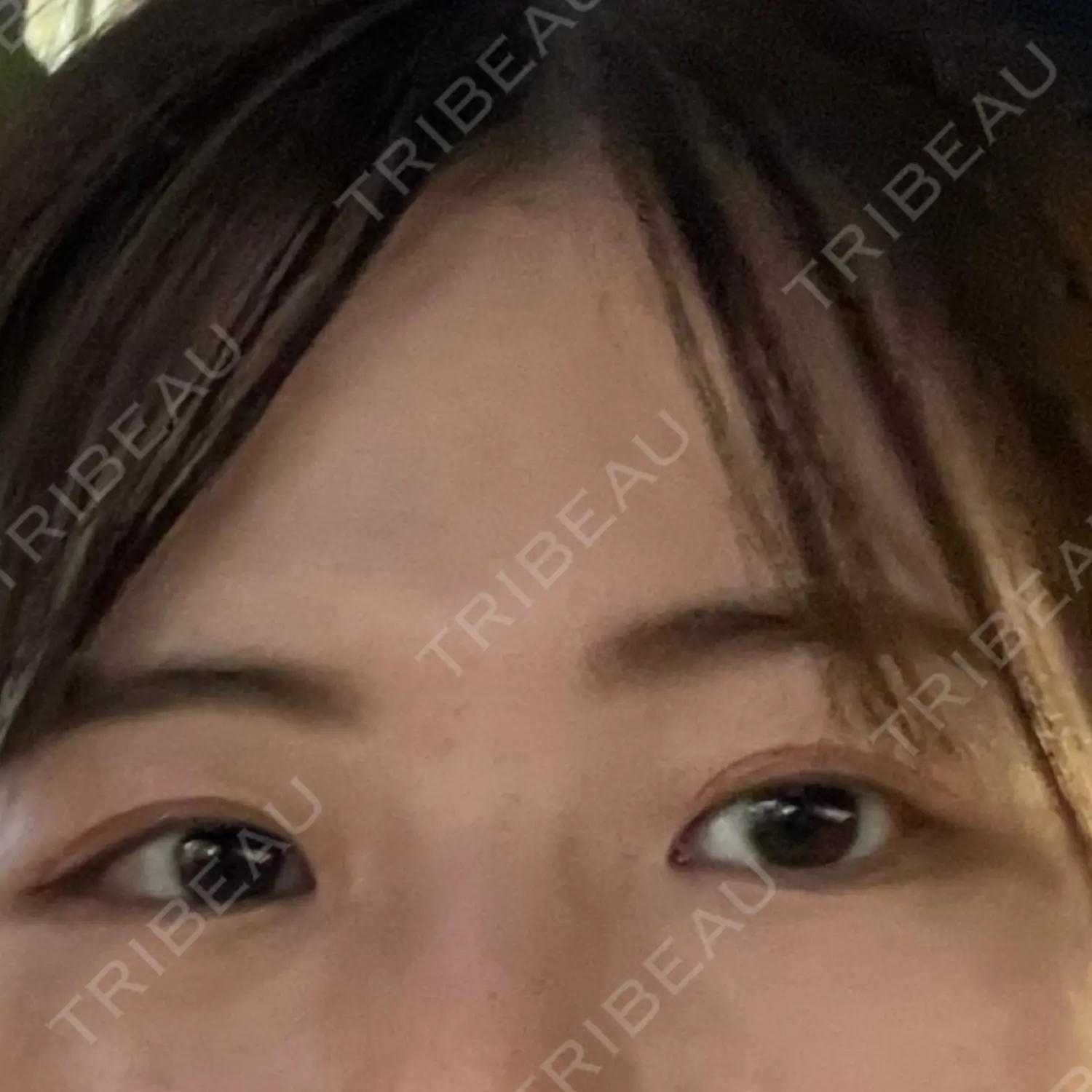 施術後の写真