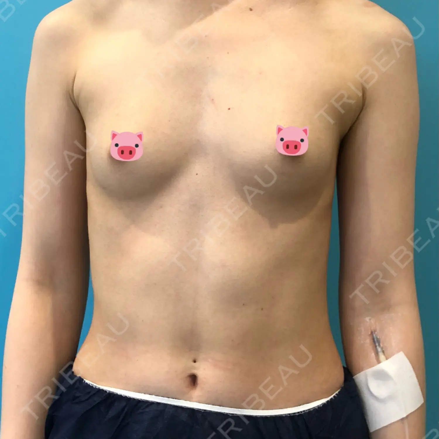 施術前の写真