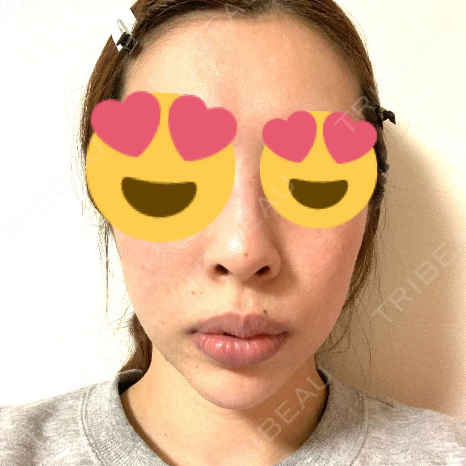 施術前の写真