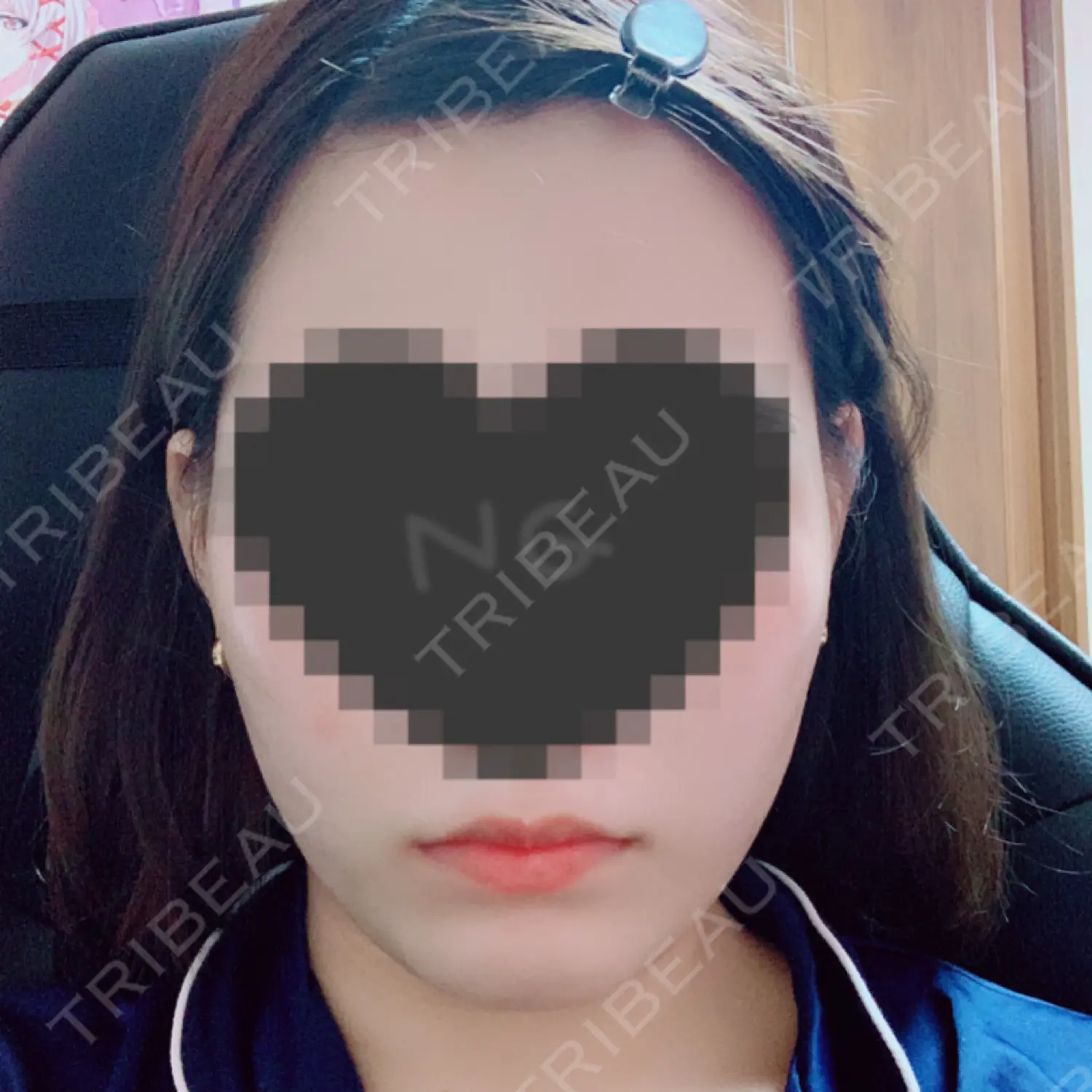 施術前の写真