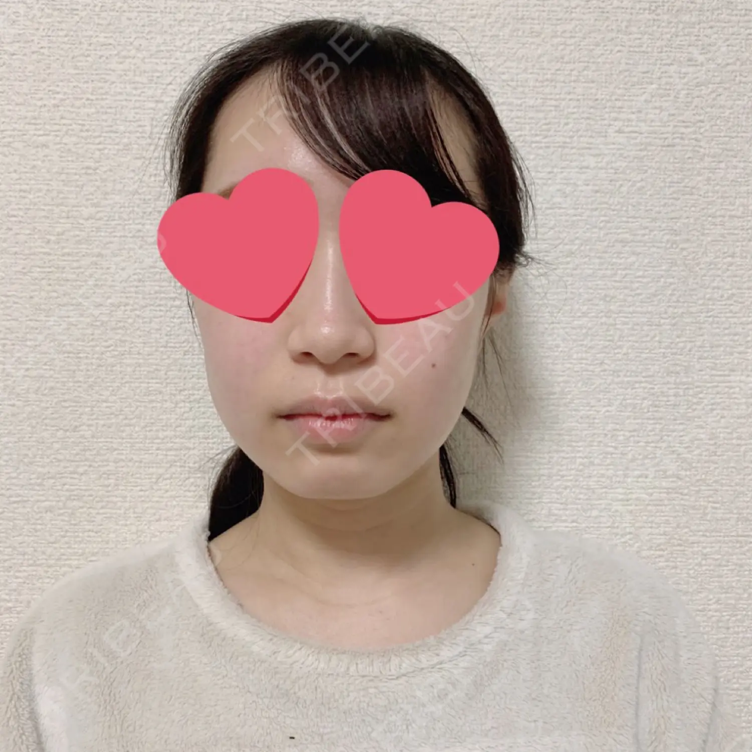 施術前の写真