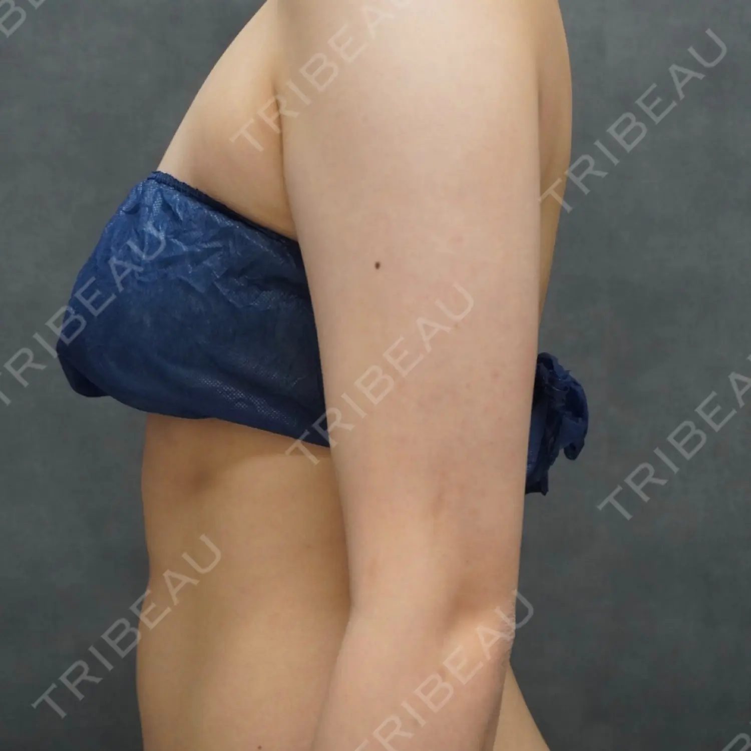 施術前の写真