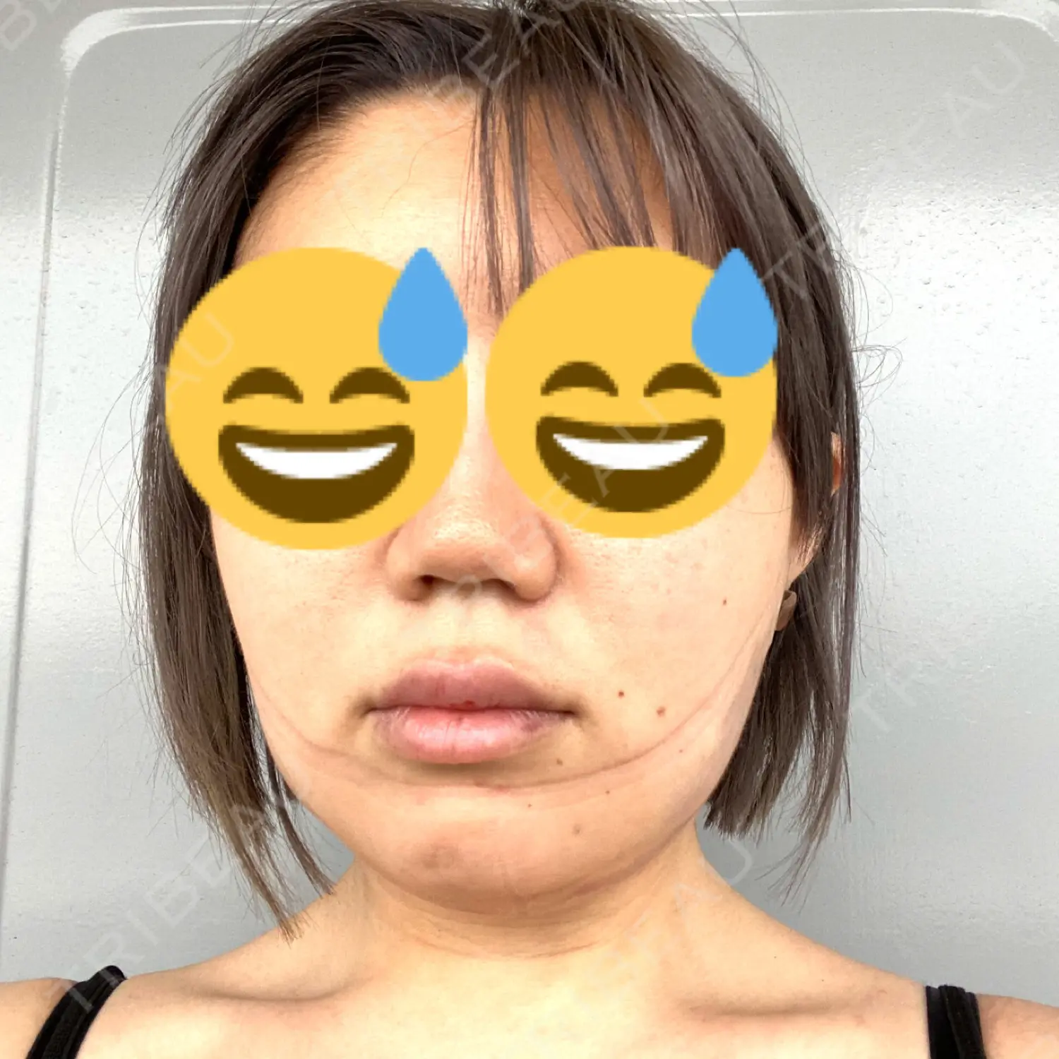 施術前の写真