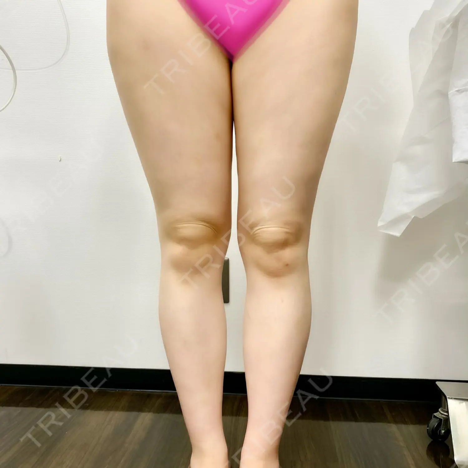 施術前の写真