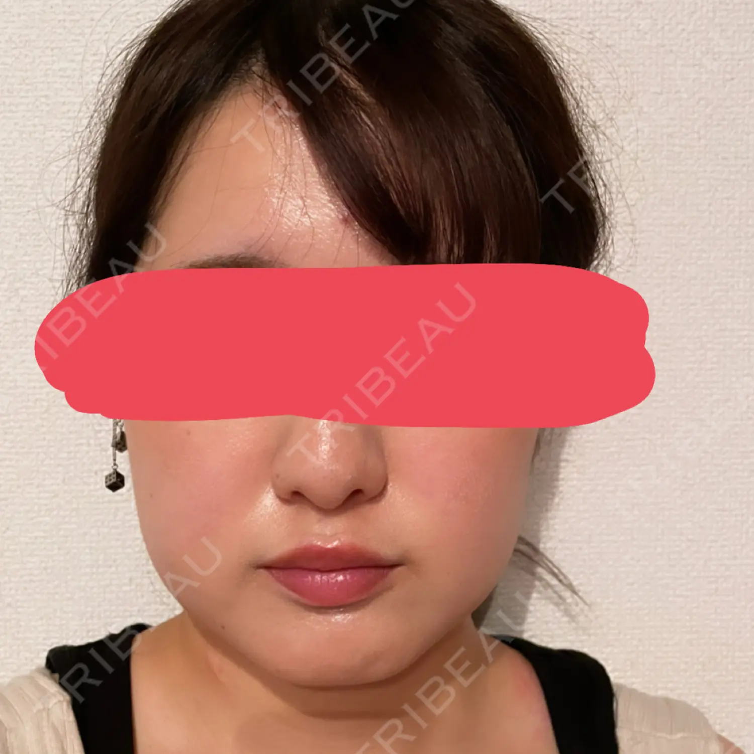 施術前の写真