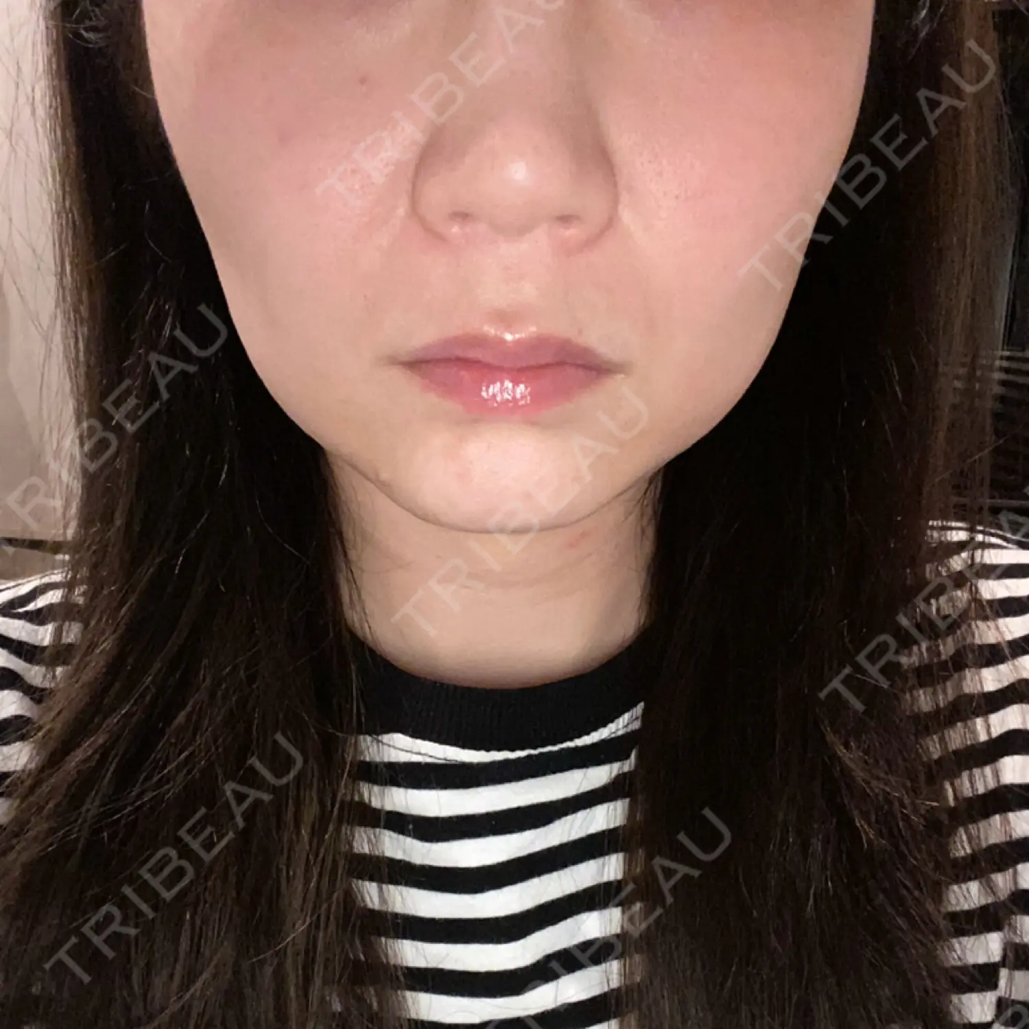 施術前の写真
