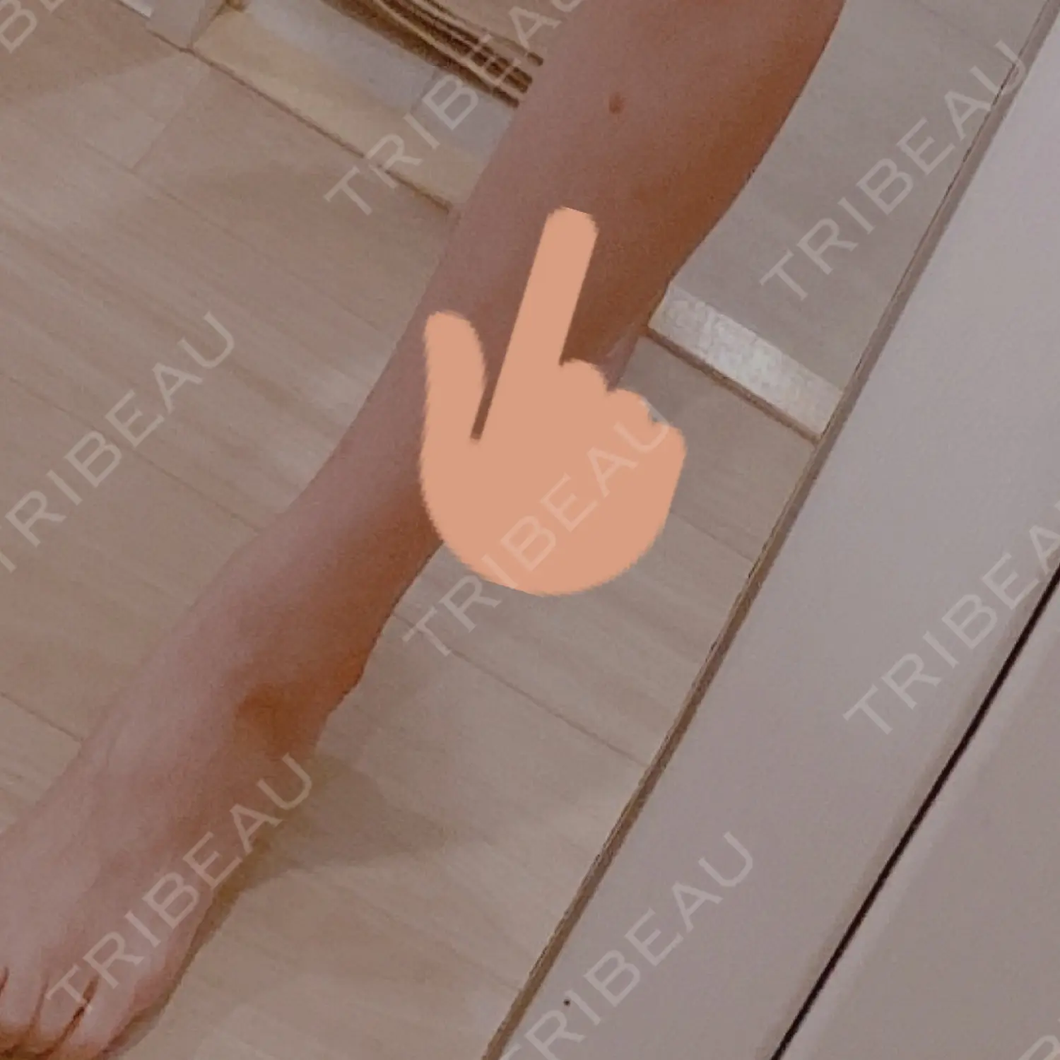 施術前の写真