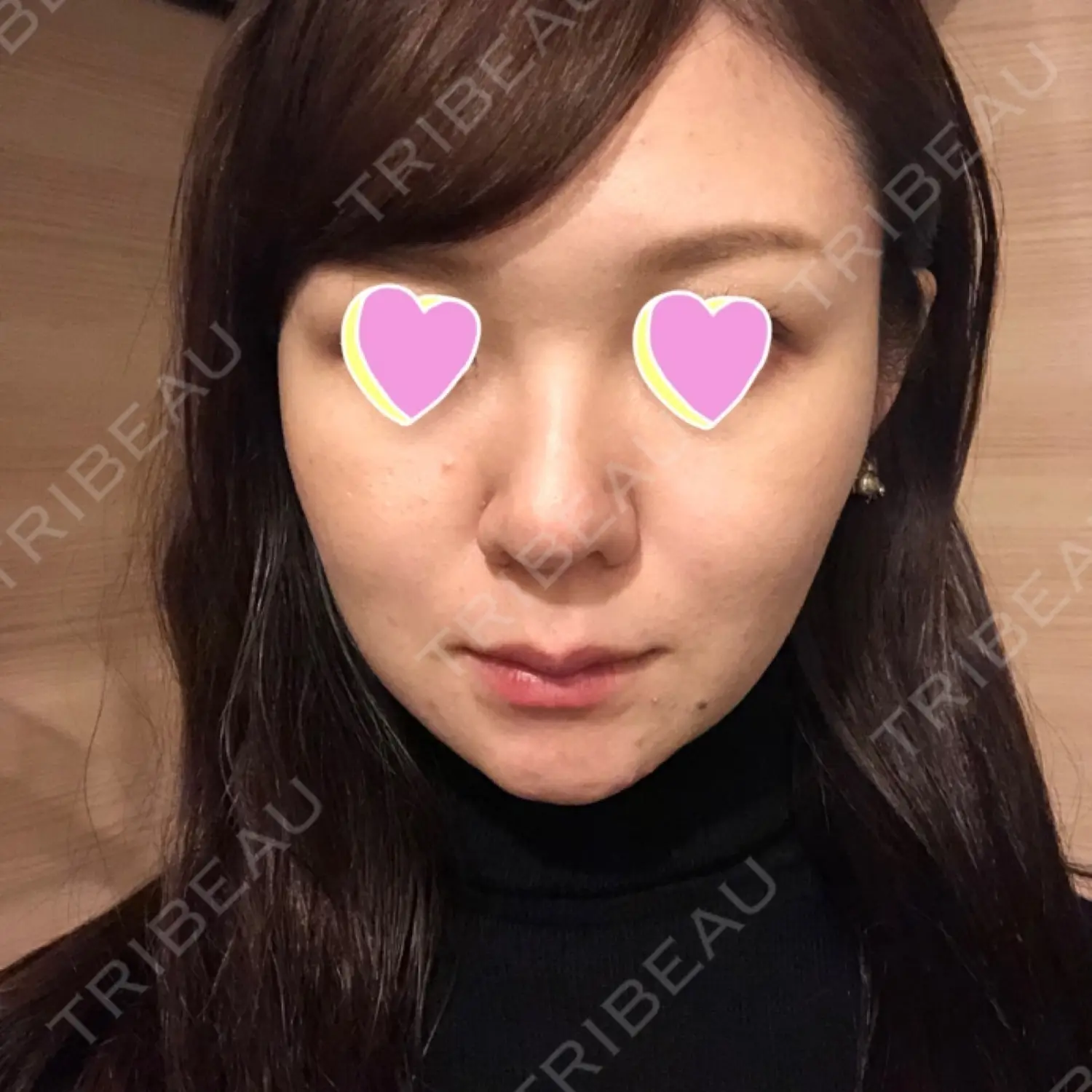 施術前の写真