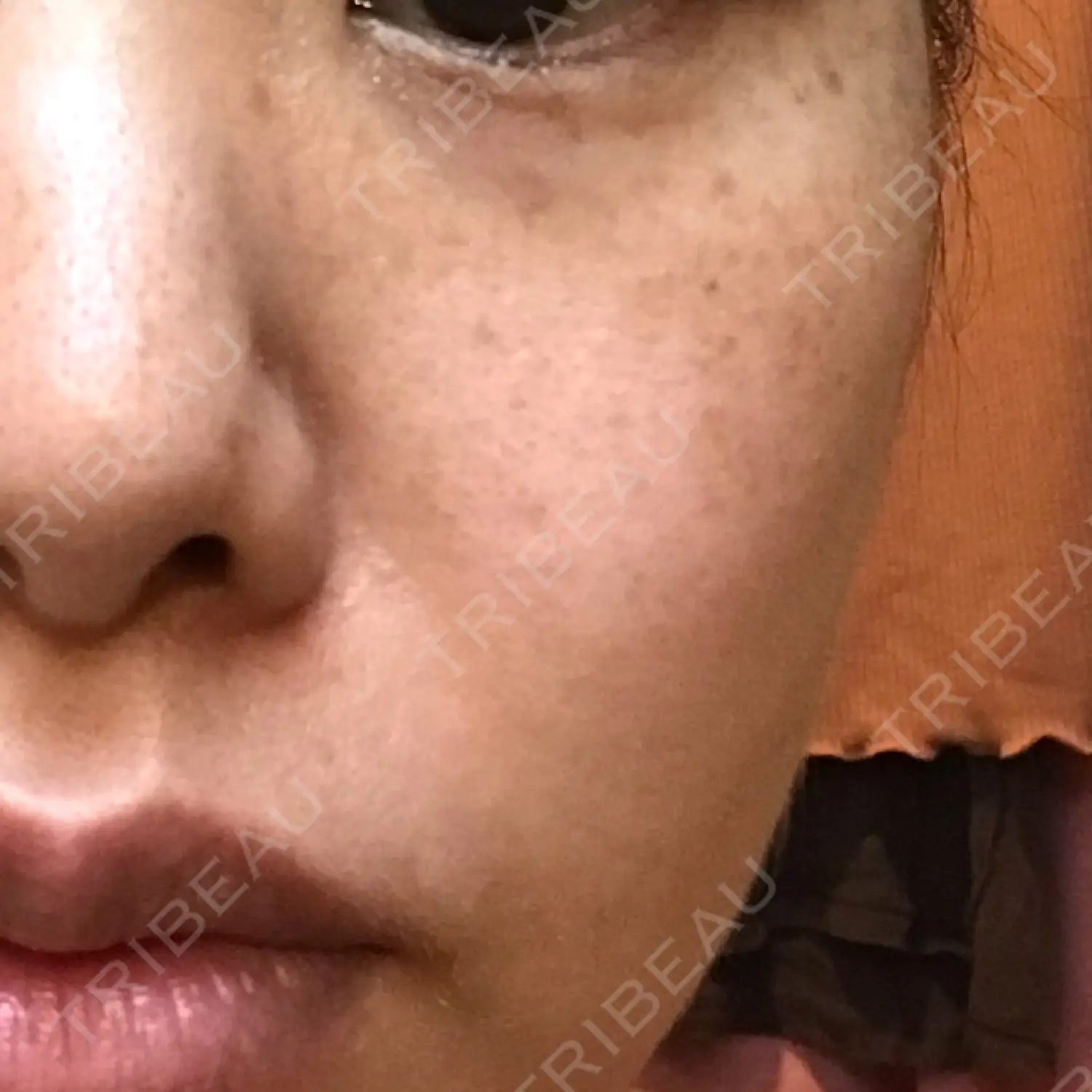 施術前の写真