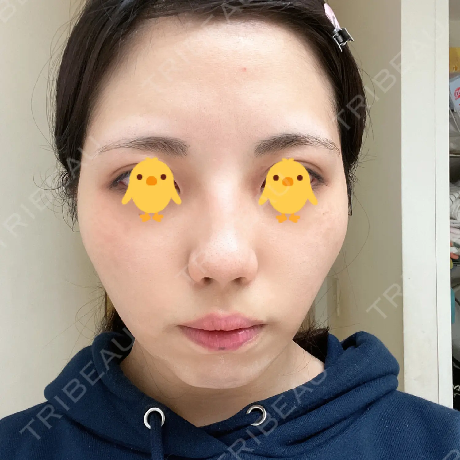 施術前の写真