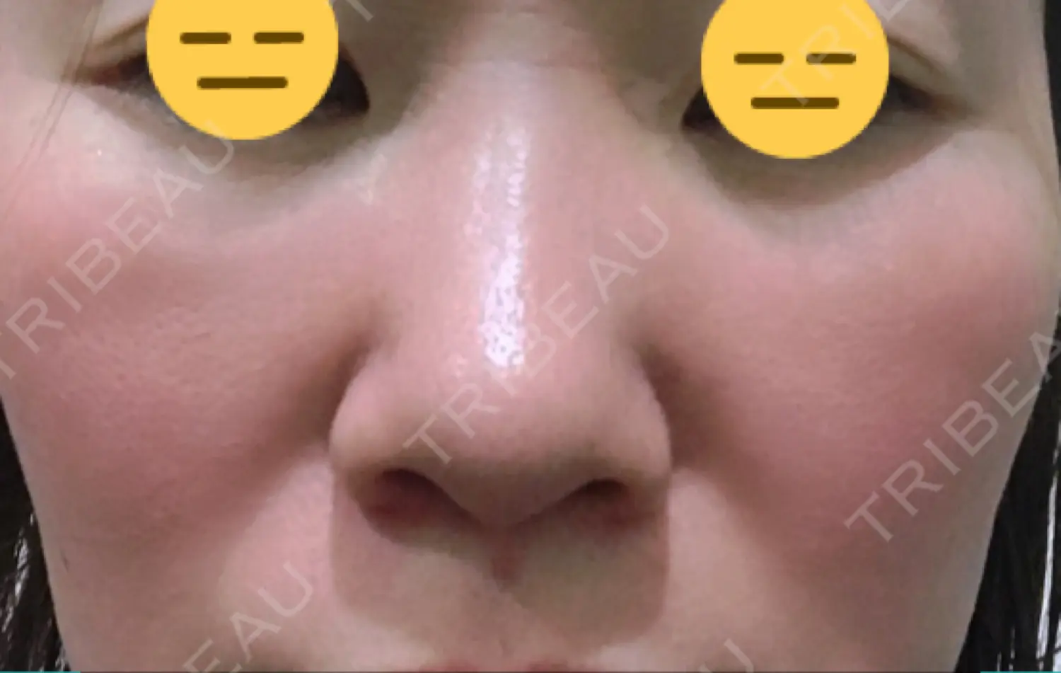 施術前の写真