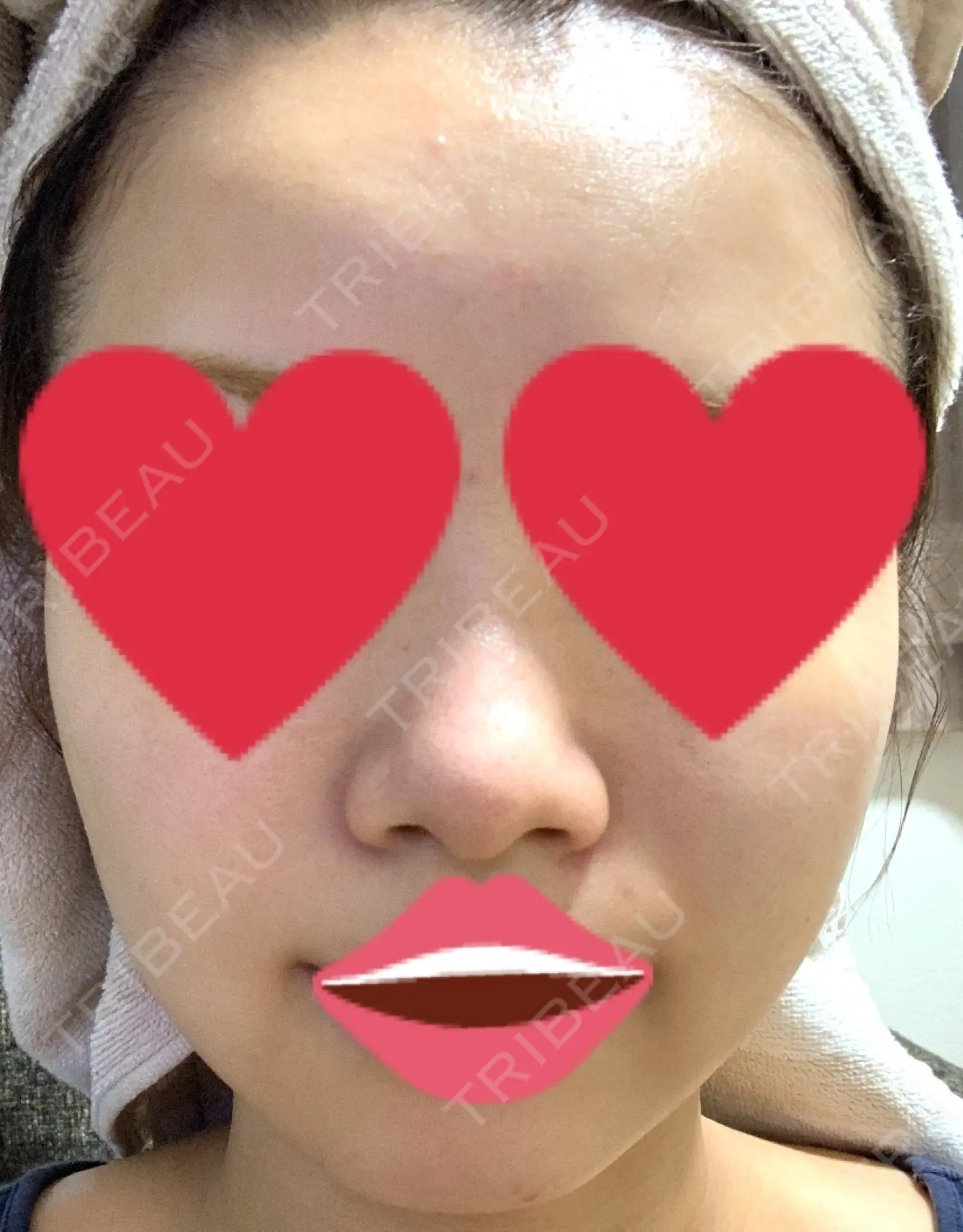 施術前の写真