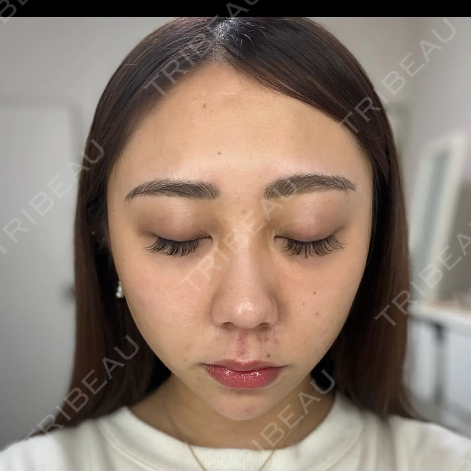 施術前の写真