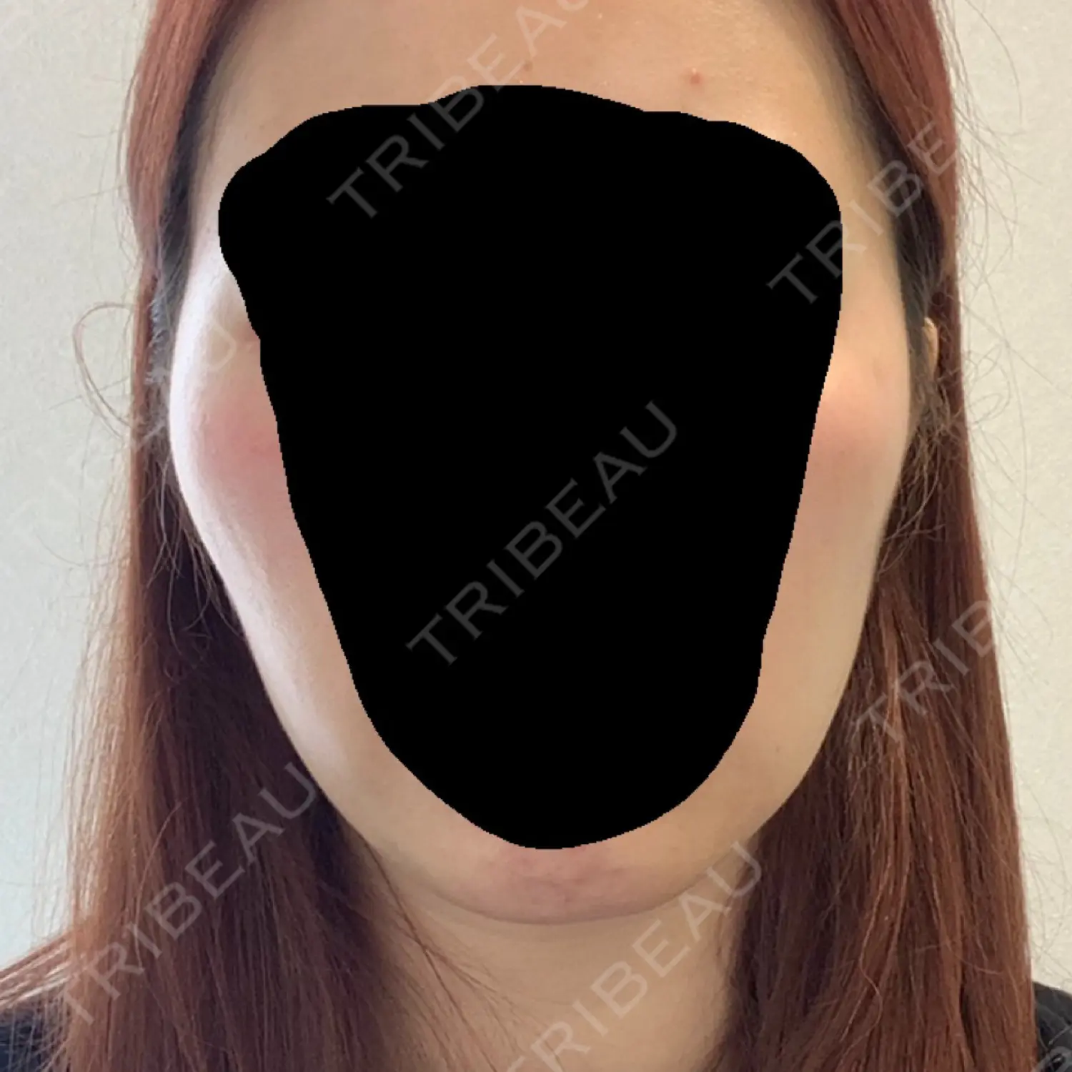 施術前の写真