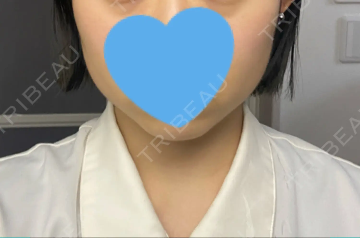 施術前の写真