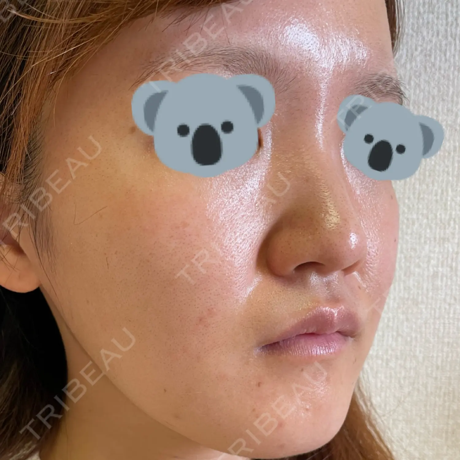 施術前の写真