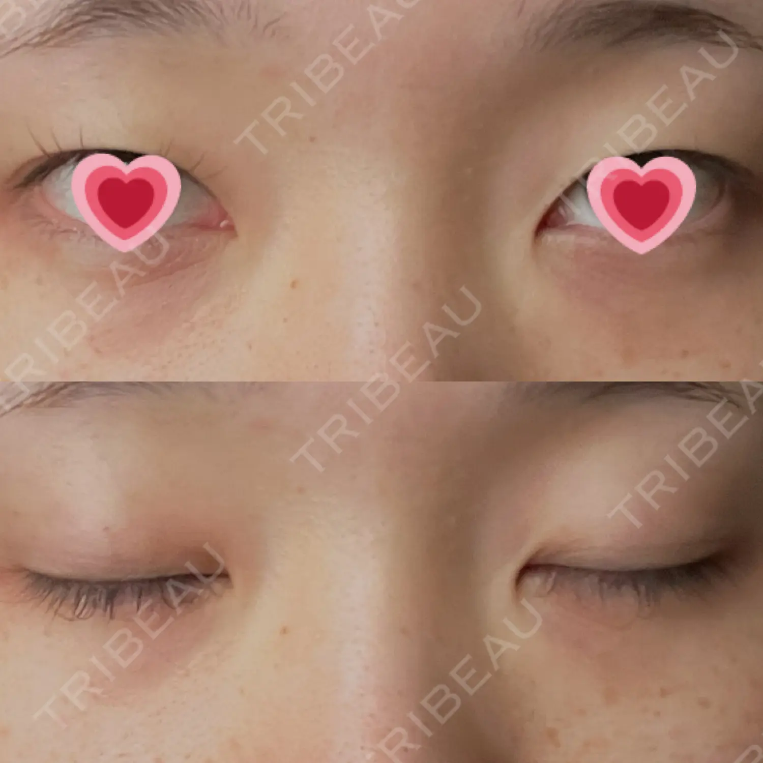 施術前の写真