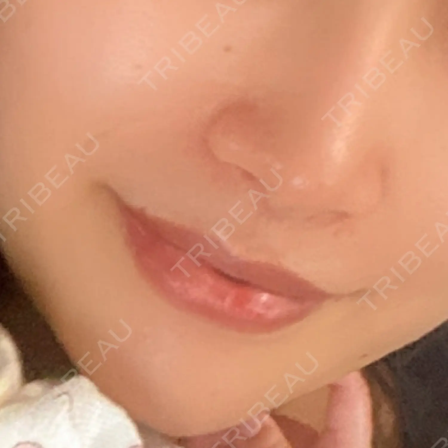 施術前の写真
