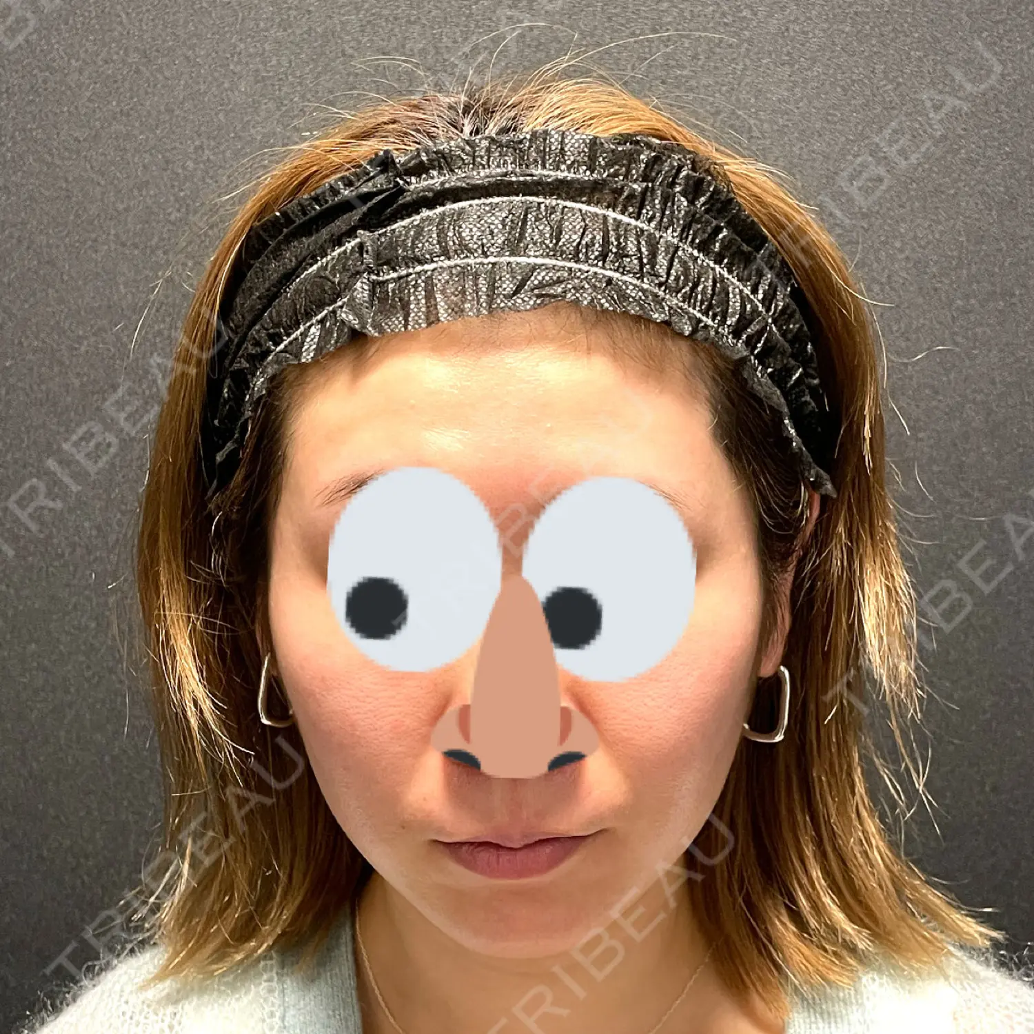 施術前の写真