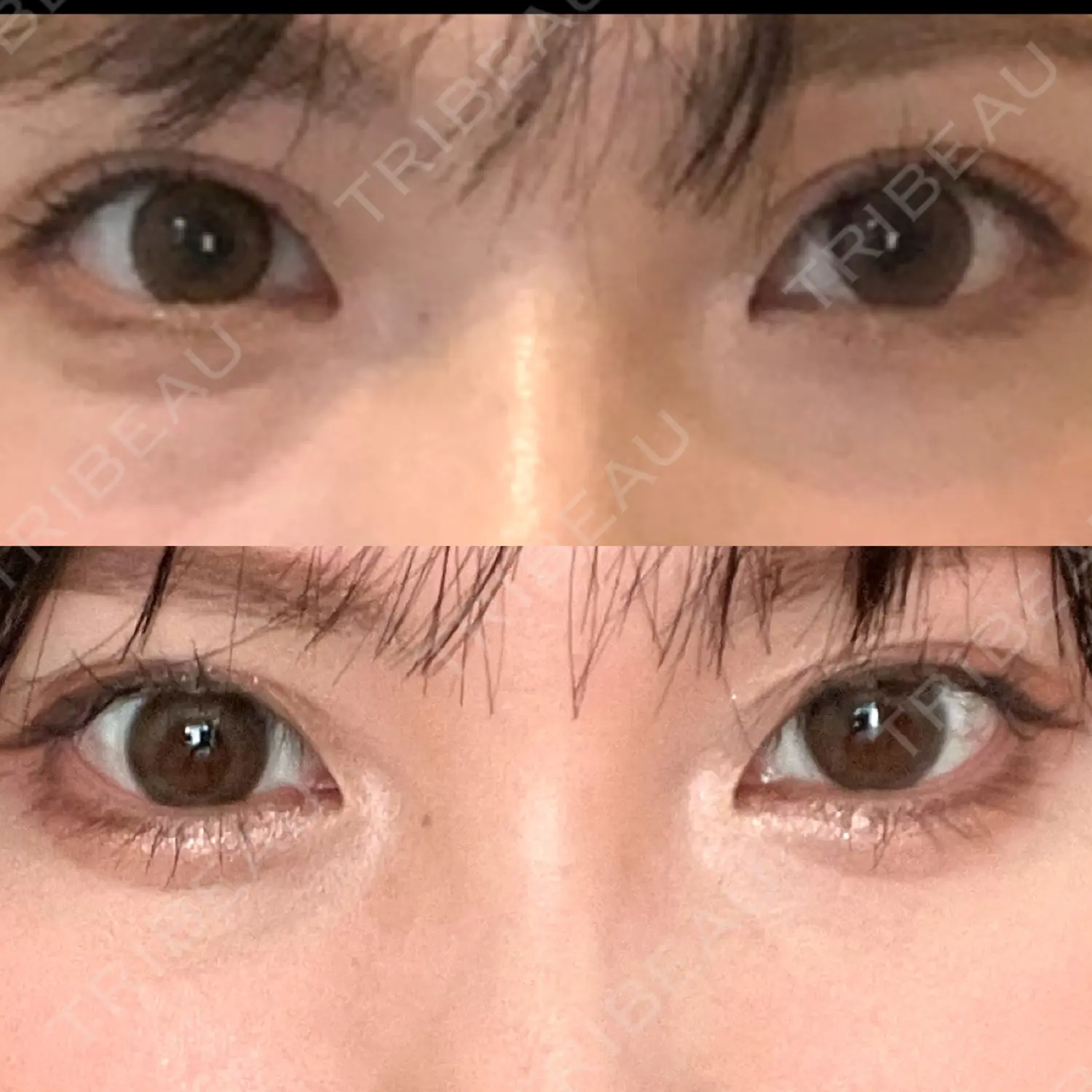 施術前の写真