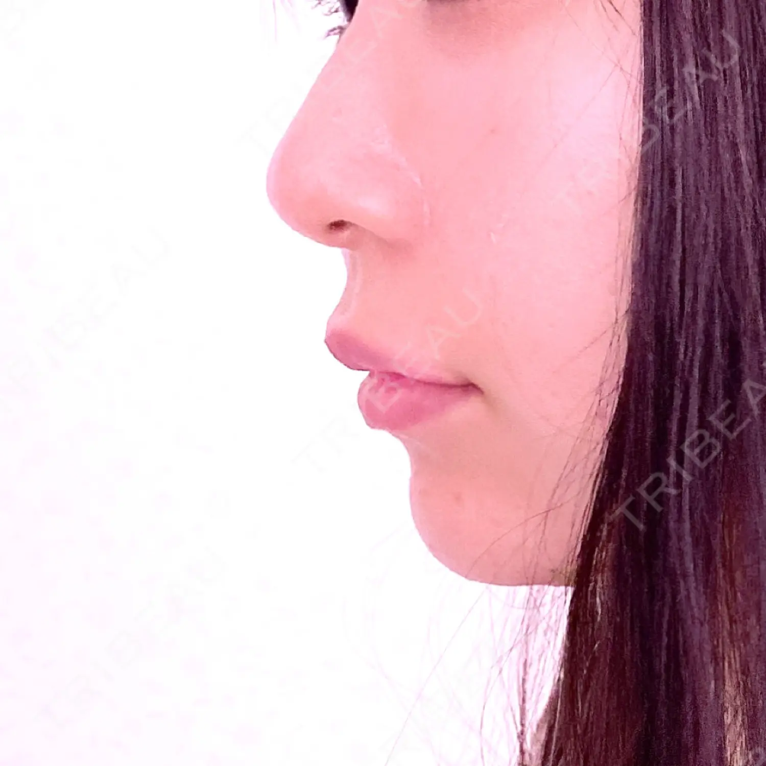 施術前の写真