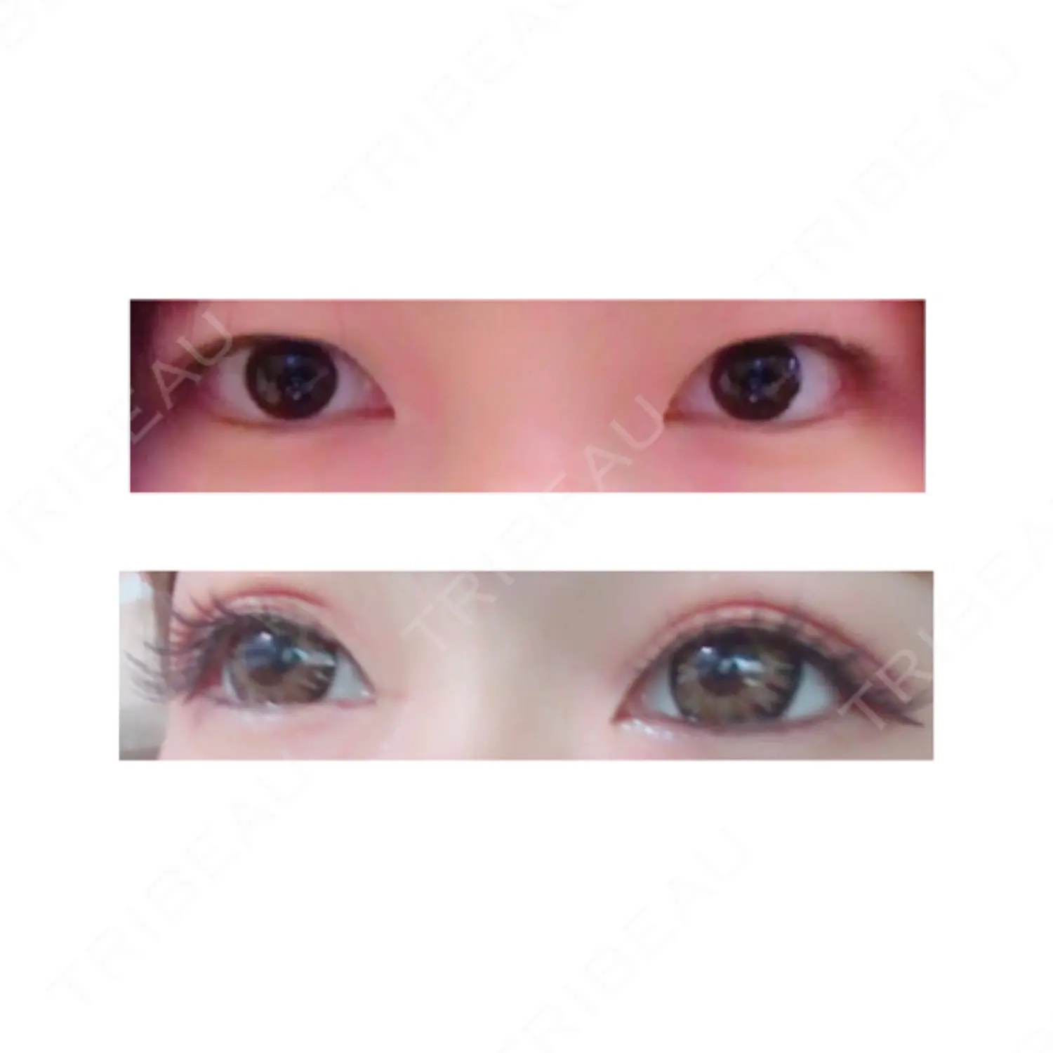 施術前の写真