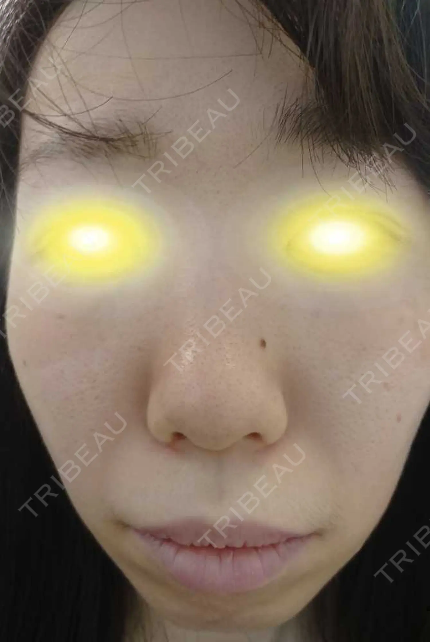 施術前の写真