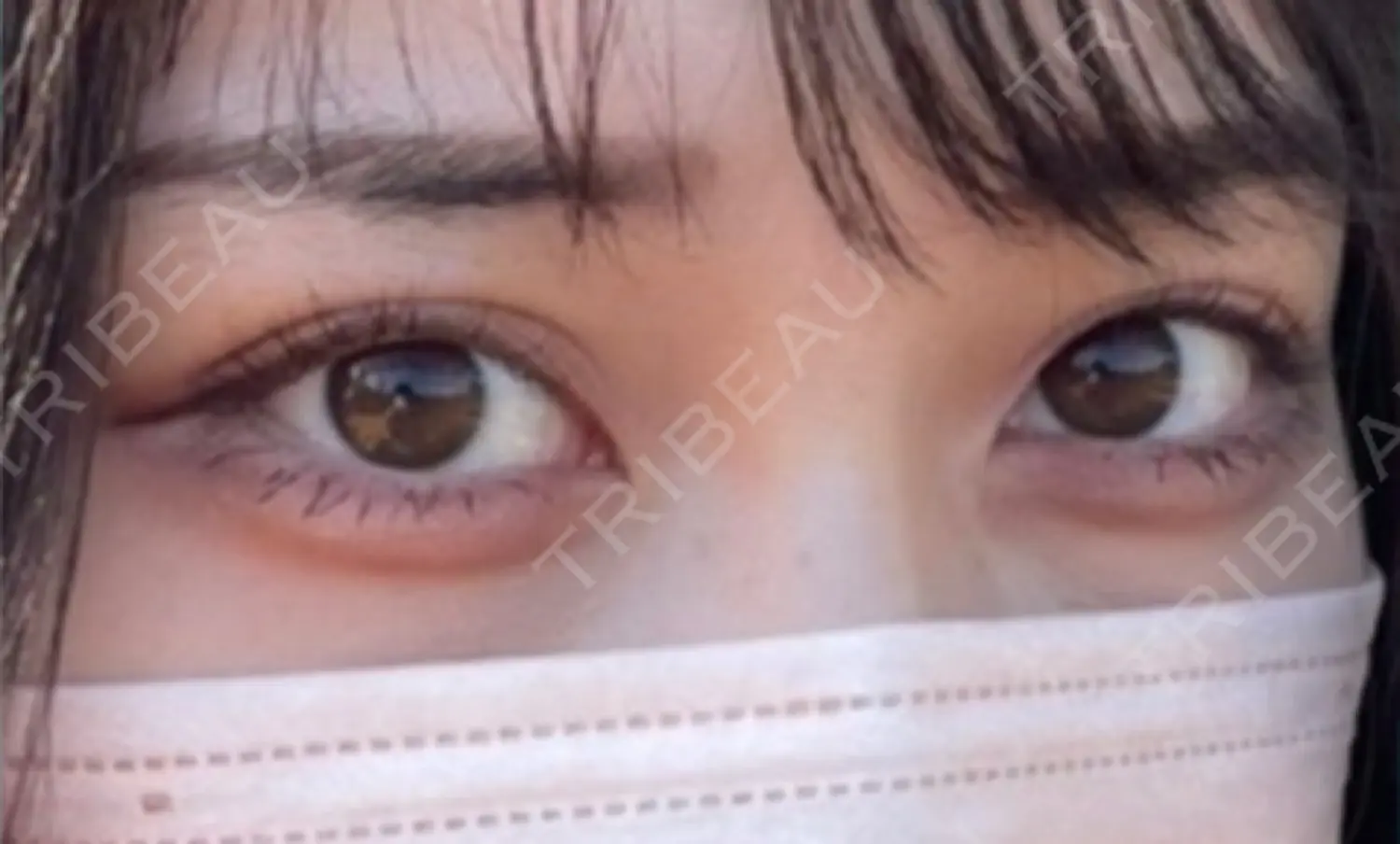 施術前の写真