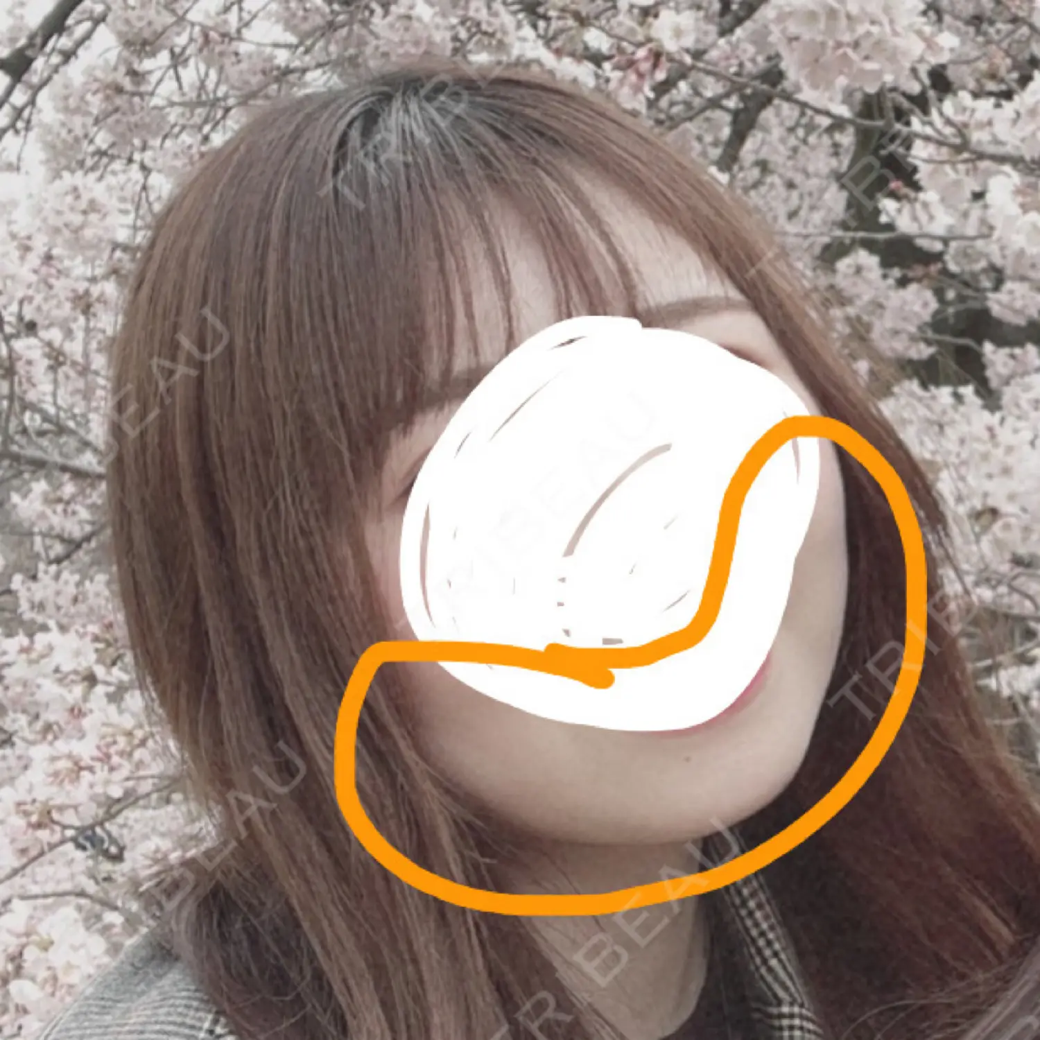 施術前の写真