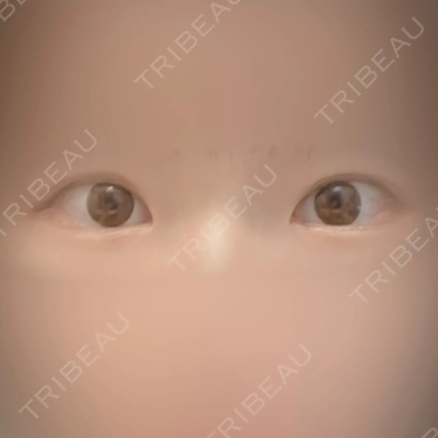施術前の写真